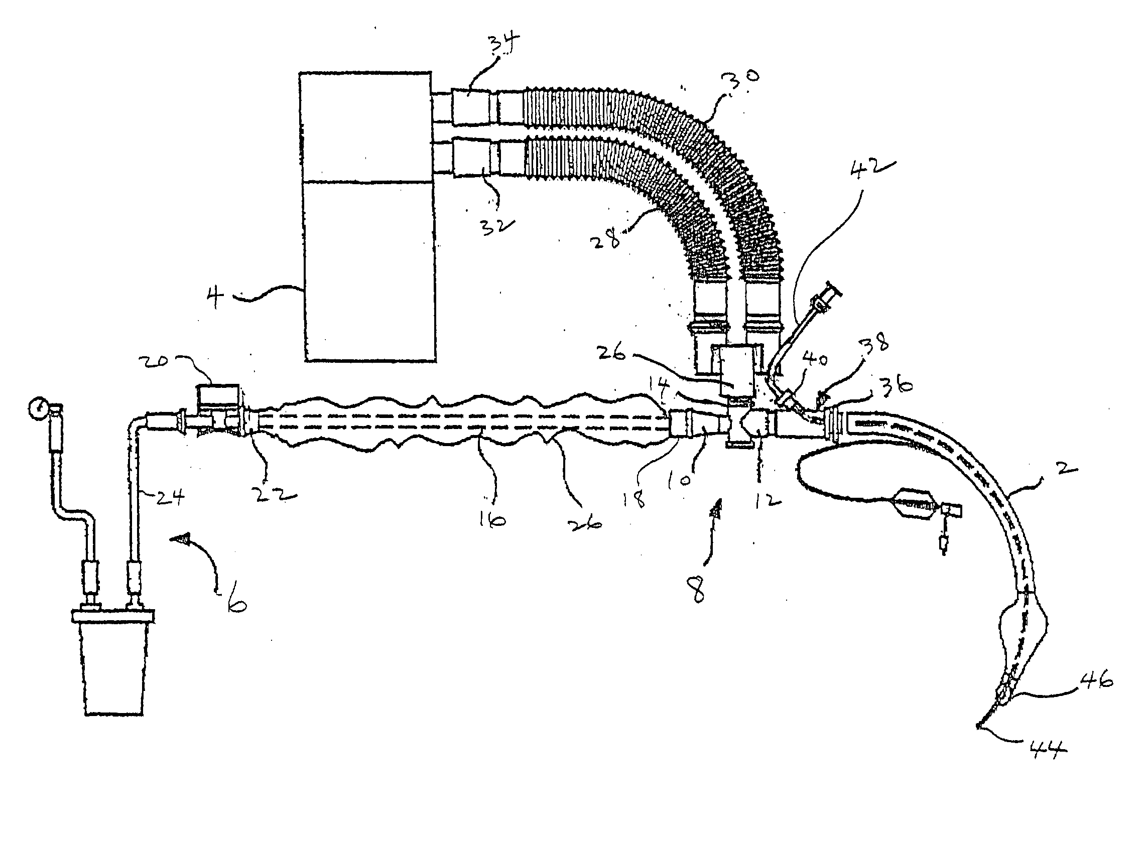 Adapter for localized treatment through a tracheal tube and method for use thereof