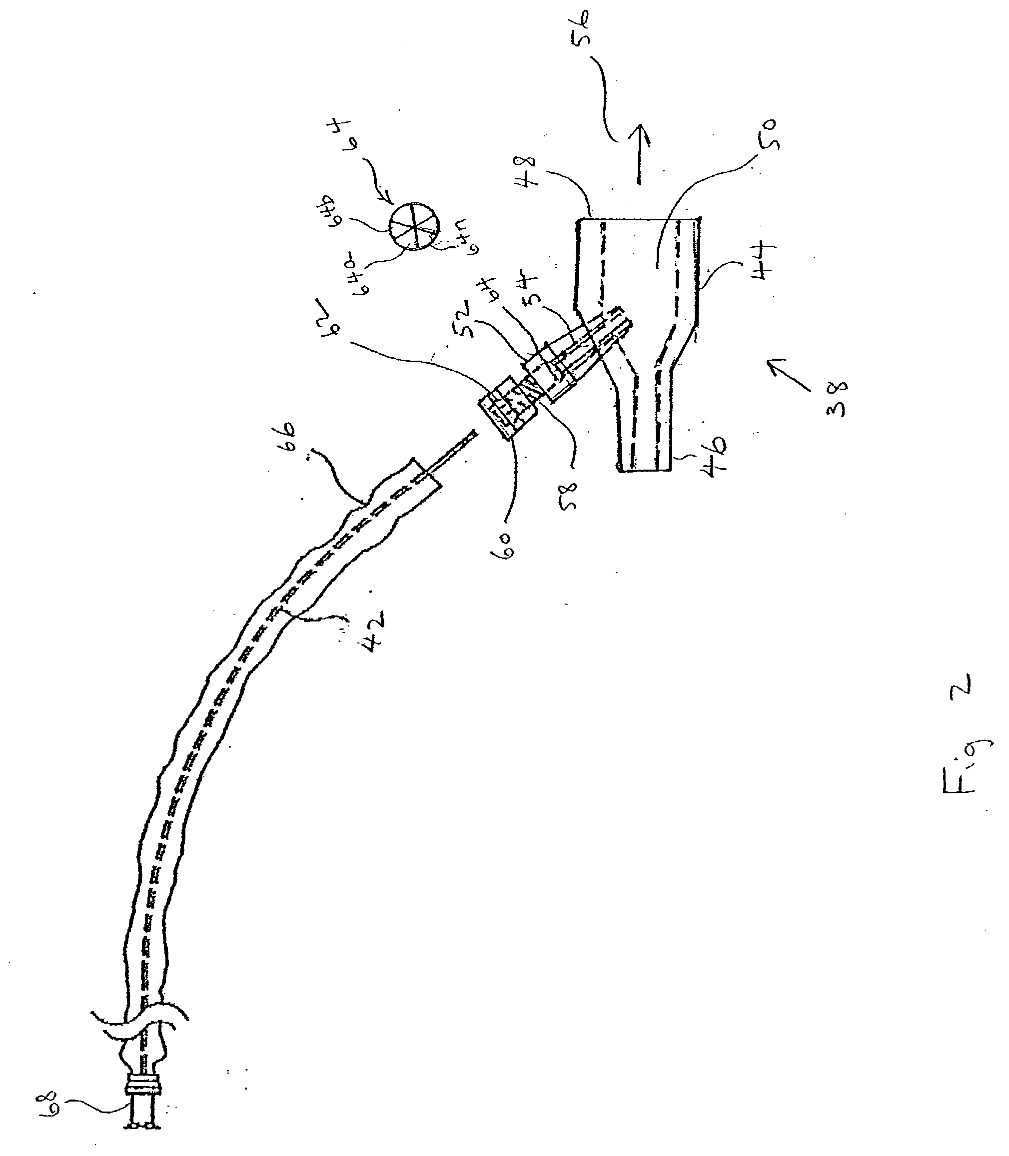 Adapter for localized treatment through a tracheal tube and method for use thereof