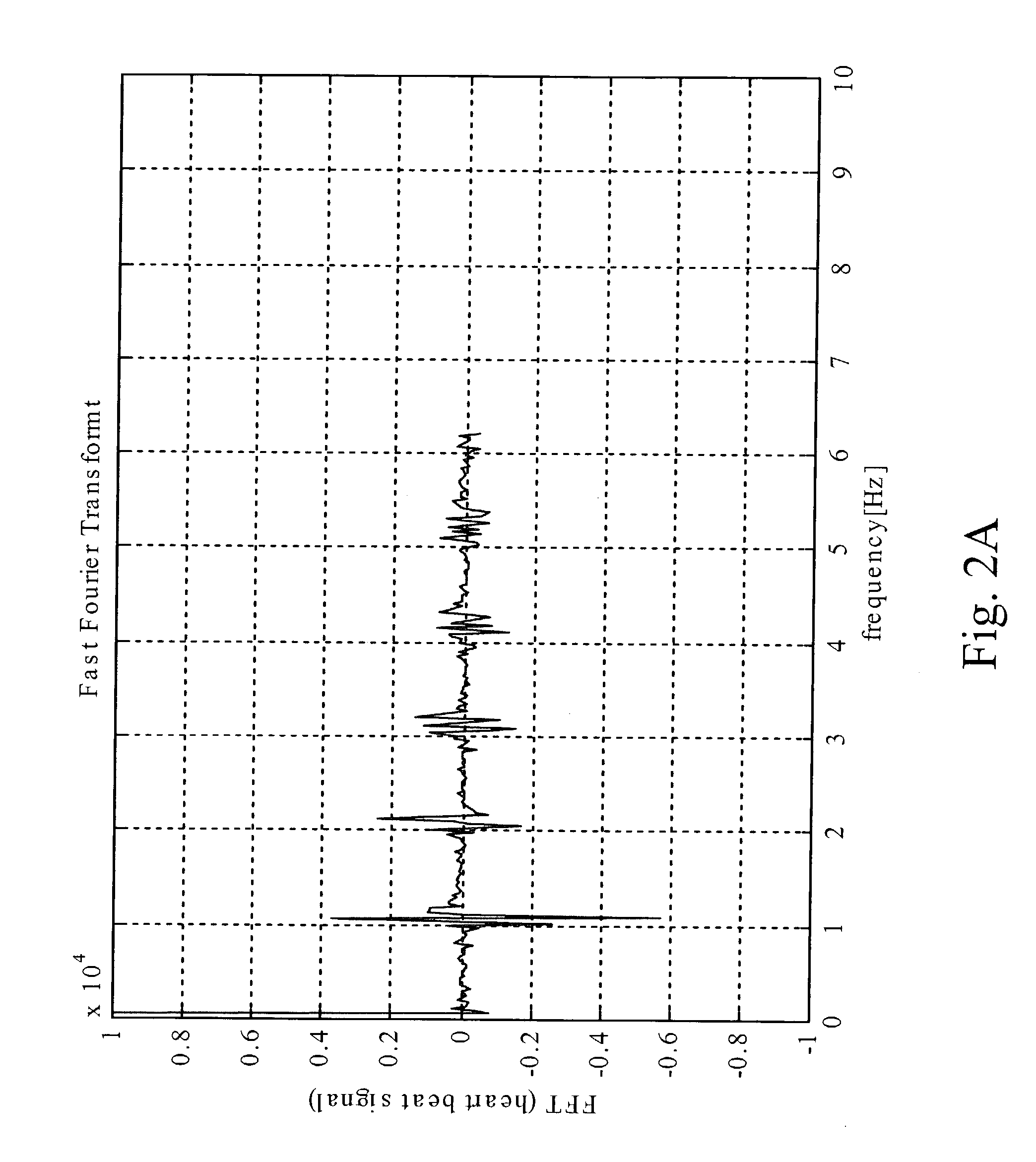 Heart state monitor method