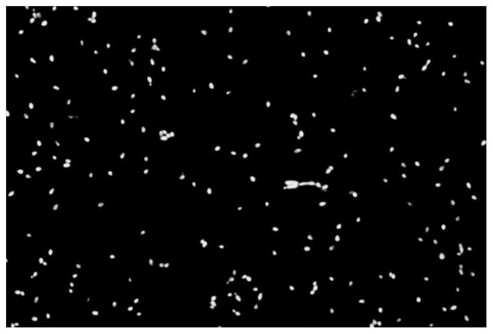 Multi-fluorescent staining solution for genital tract secretions as well as preparation method and application of multi-fluorescent staining solution