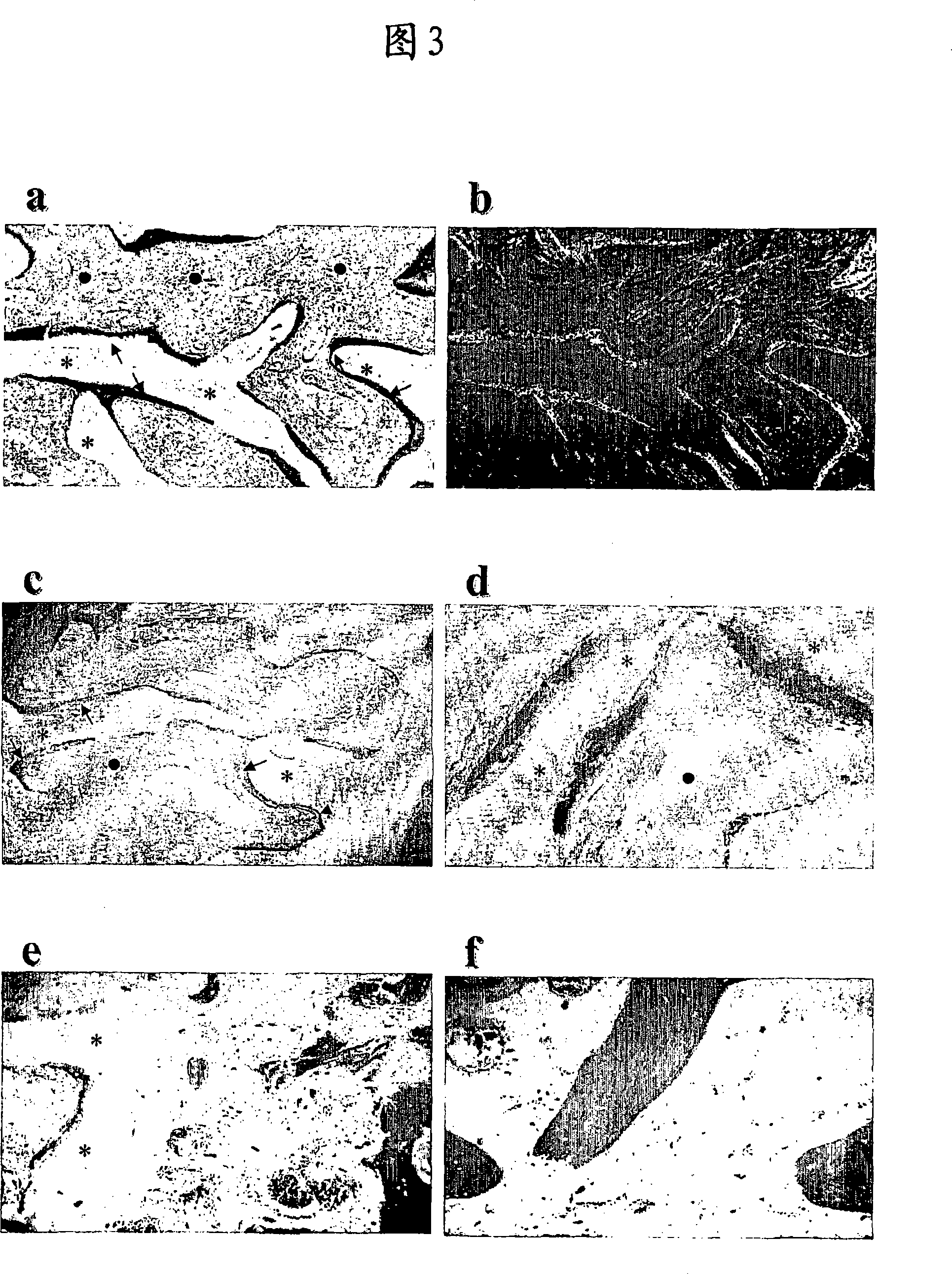 Cartilage and bone repair composition.