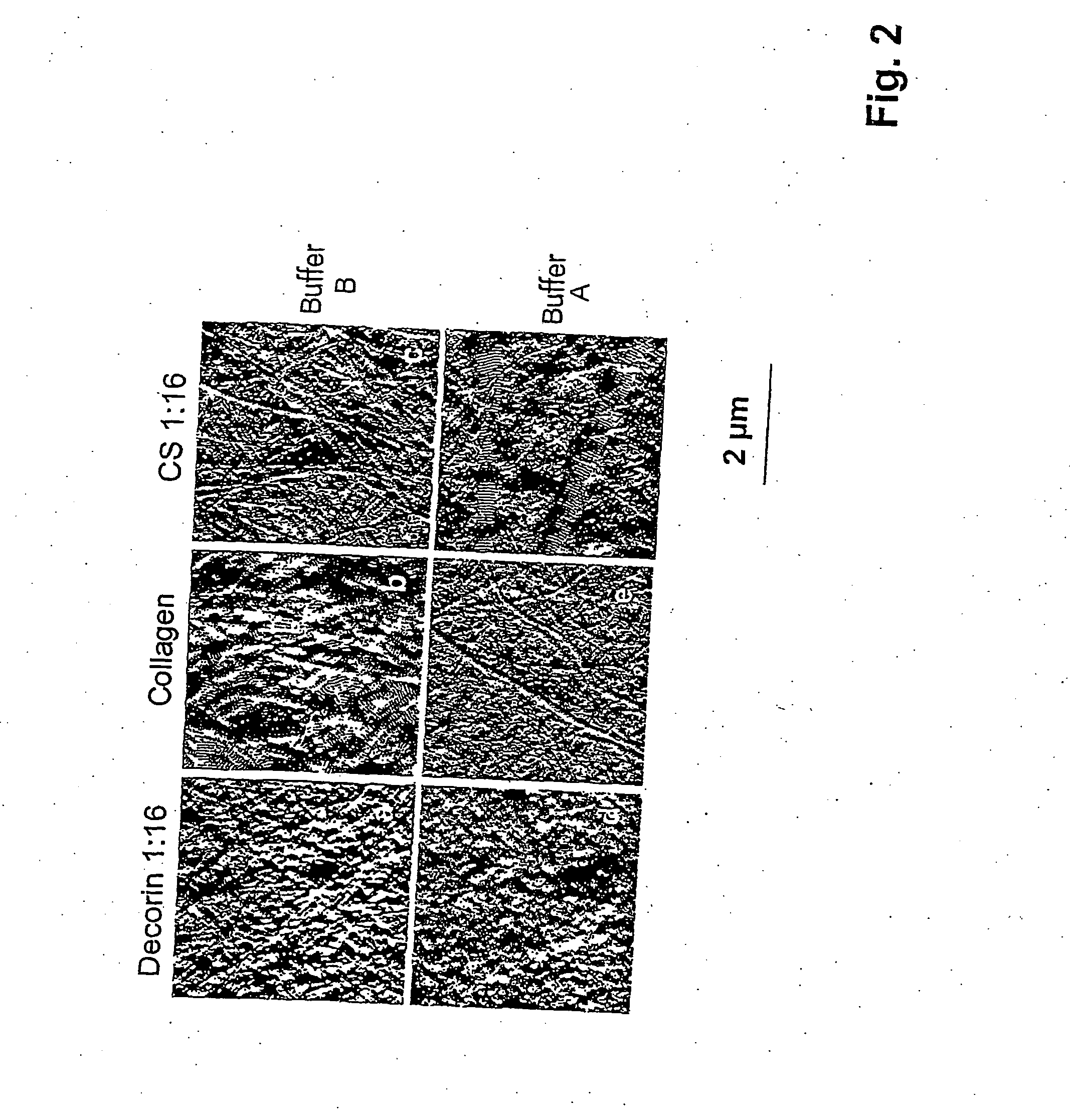 Osteogenic Composite Matrix, Method for the Production Thereof and Implant and Scaffold for Tissue Engineering Provided with a Coating Formed by Said Osteogenic Composite matrix