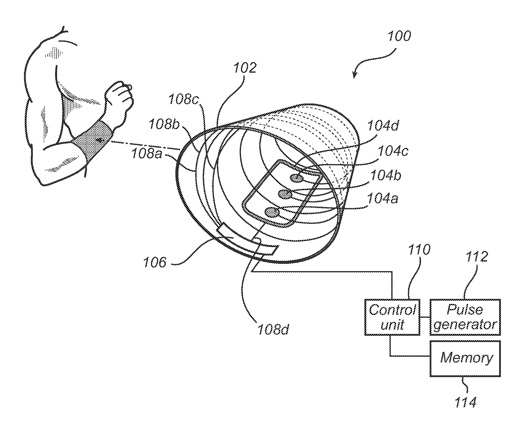 Wearable device and system for a tamper free electric stimulation of a body