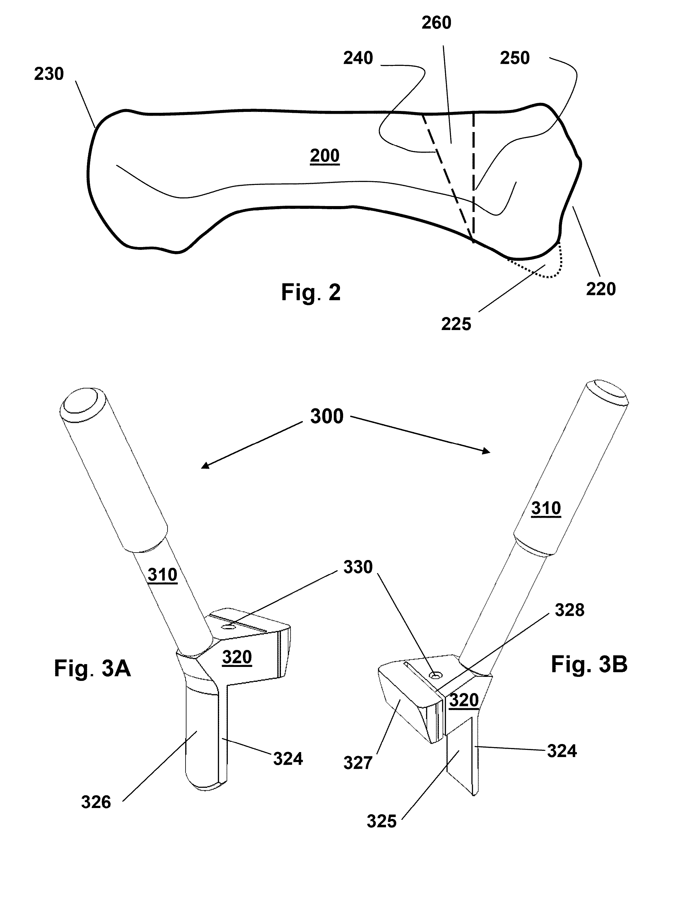 Devices, implements and methods for the treatment of a multi-axis joint