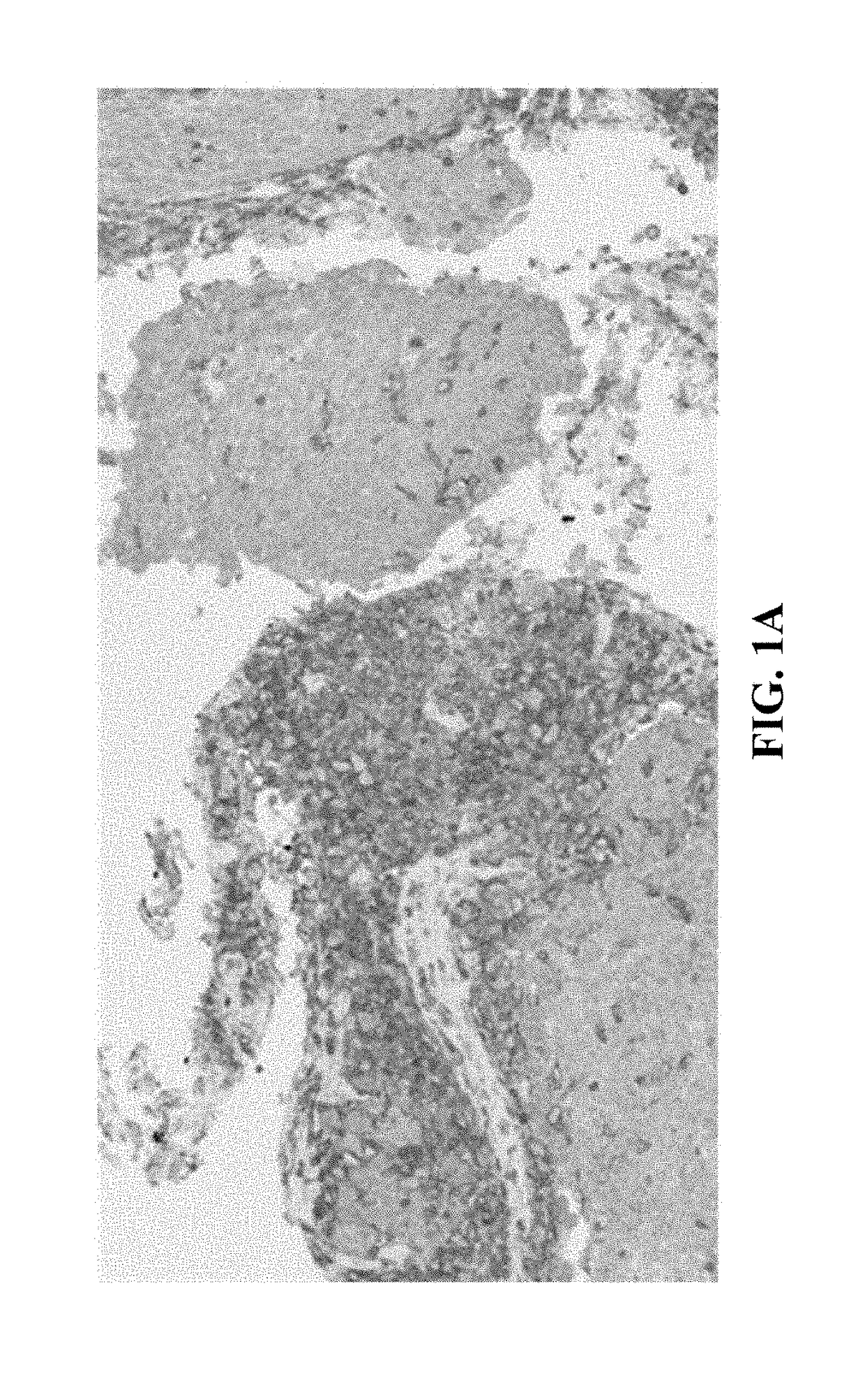 Methods of identifying immune cells in pd-l1 positive tumor tissue