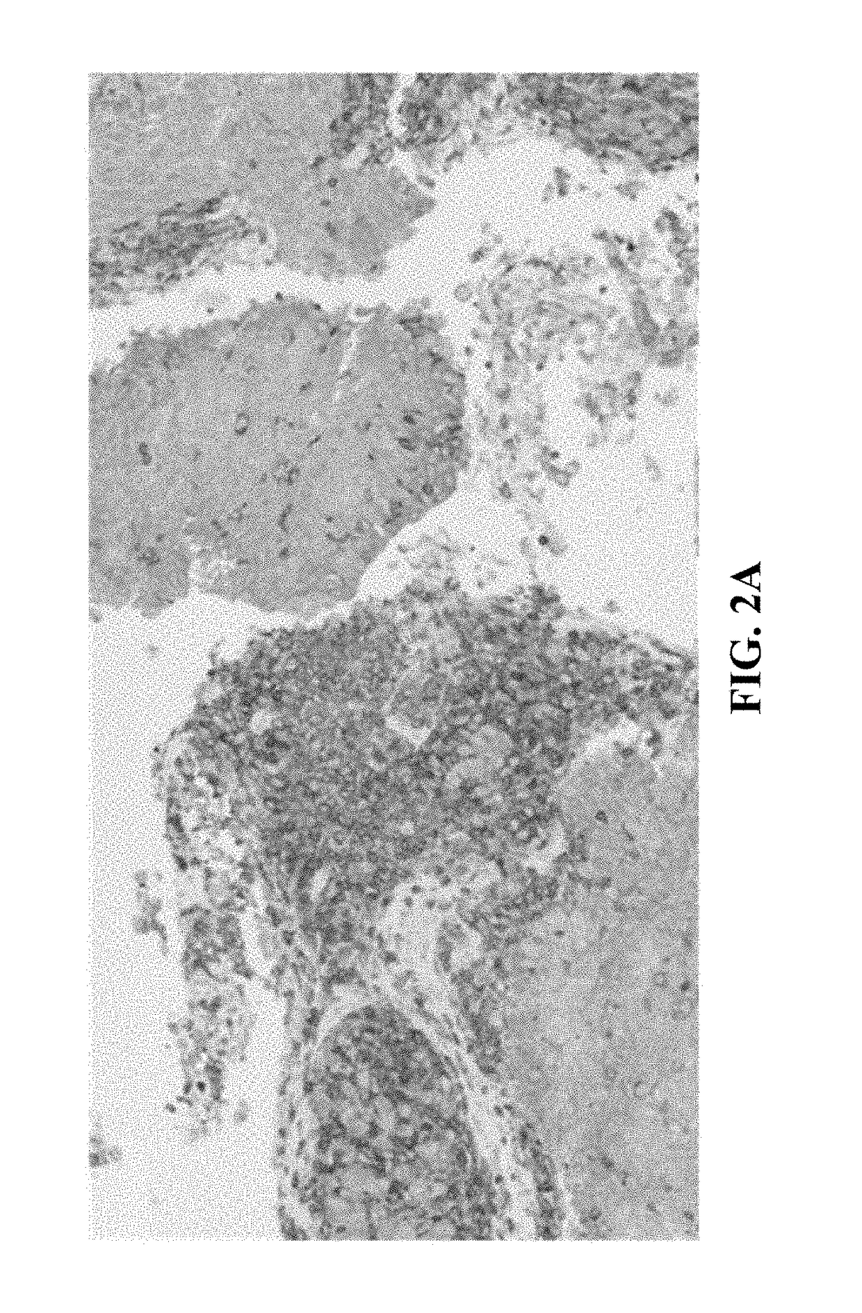 Methods of identifying immune cells in pd-l1 positive tumor tissue