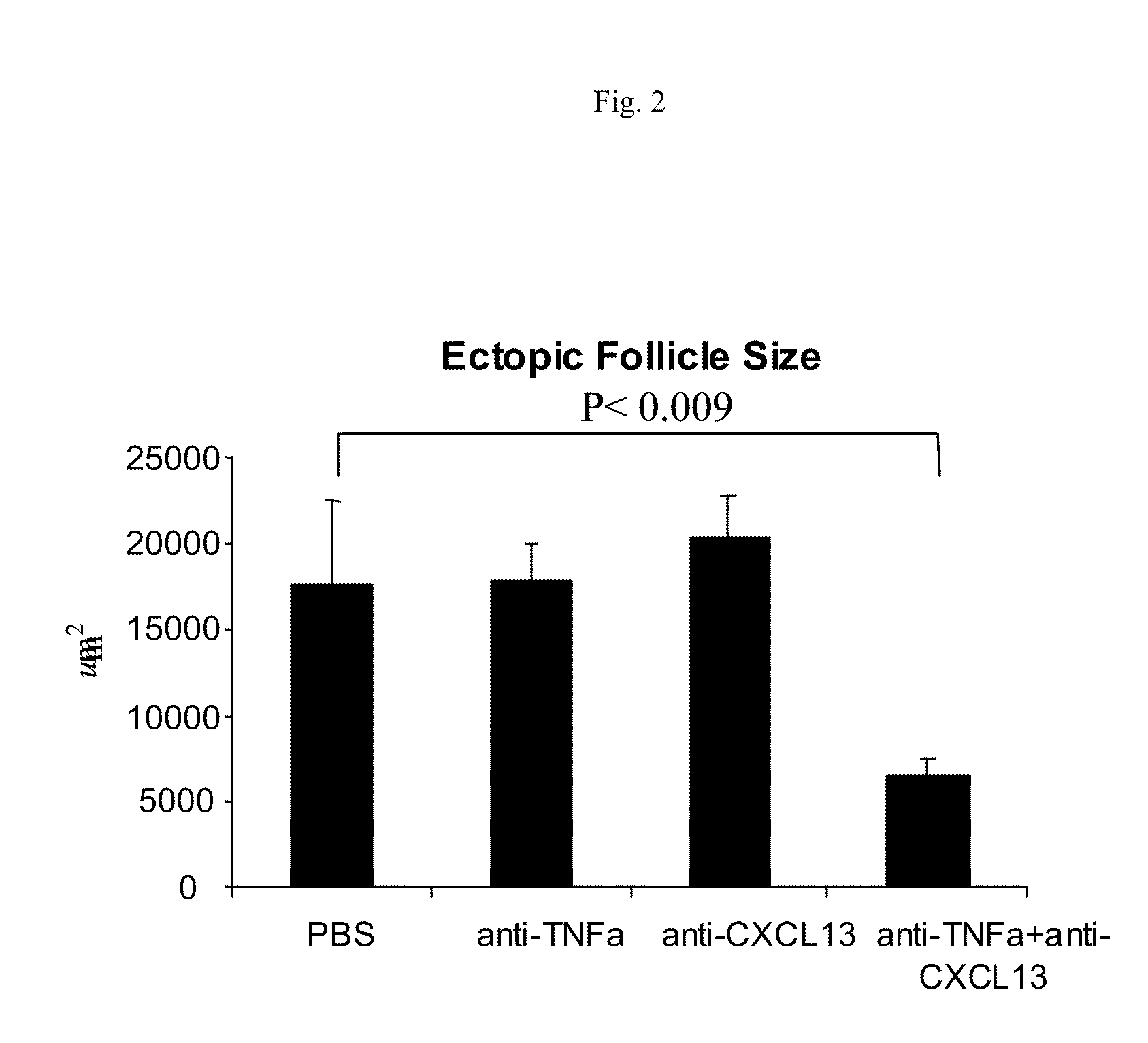 CXCL13 Antagonists and Their Use for the Treatment of Inflammatory Diseases