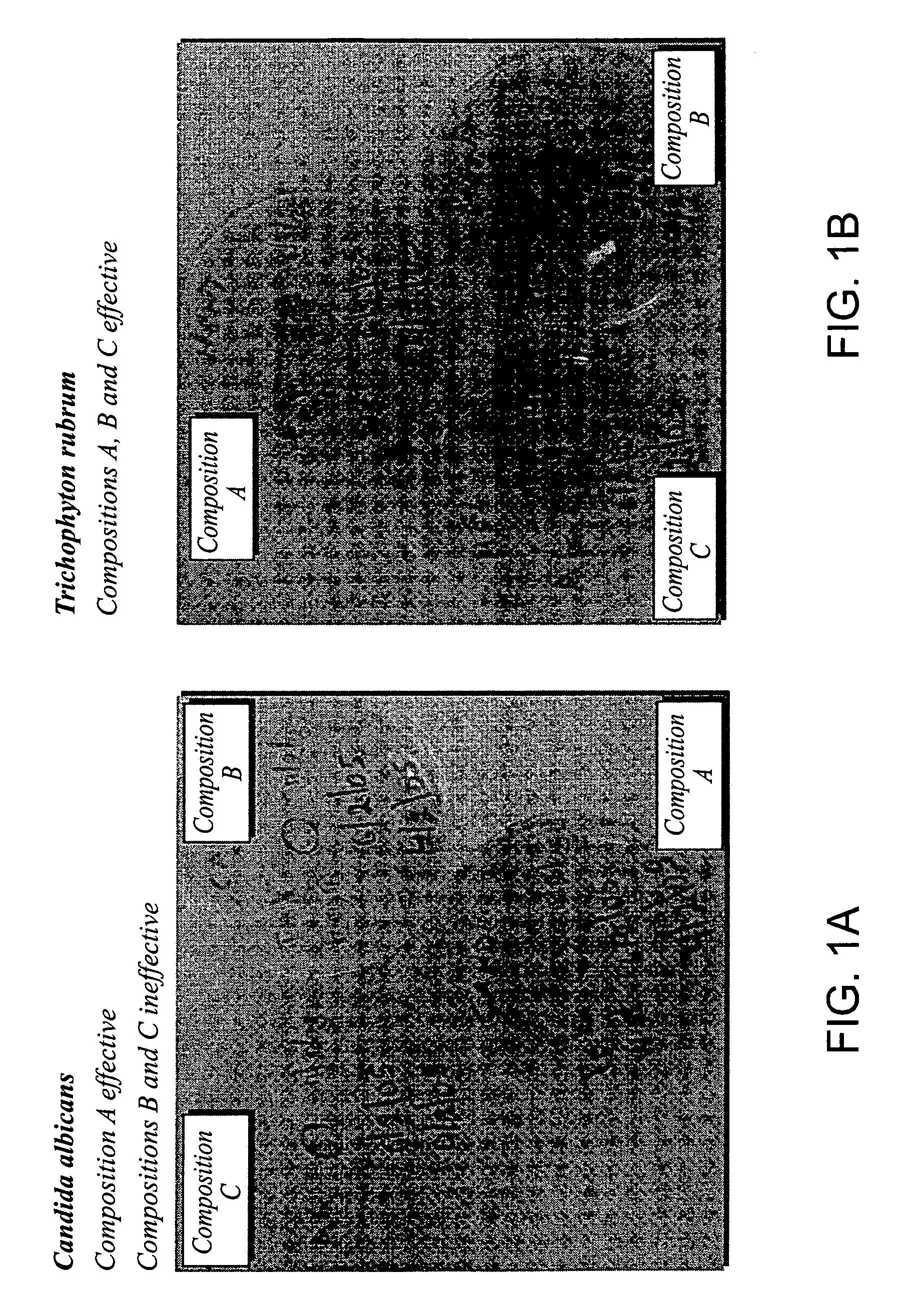 Foamable vehicle and pharmaceutical compositions thereof