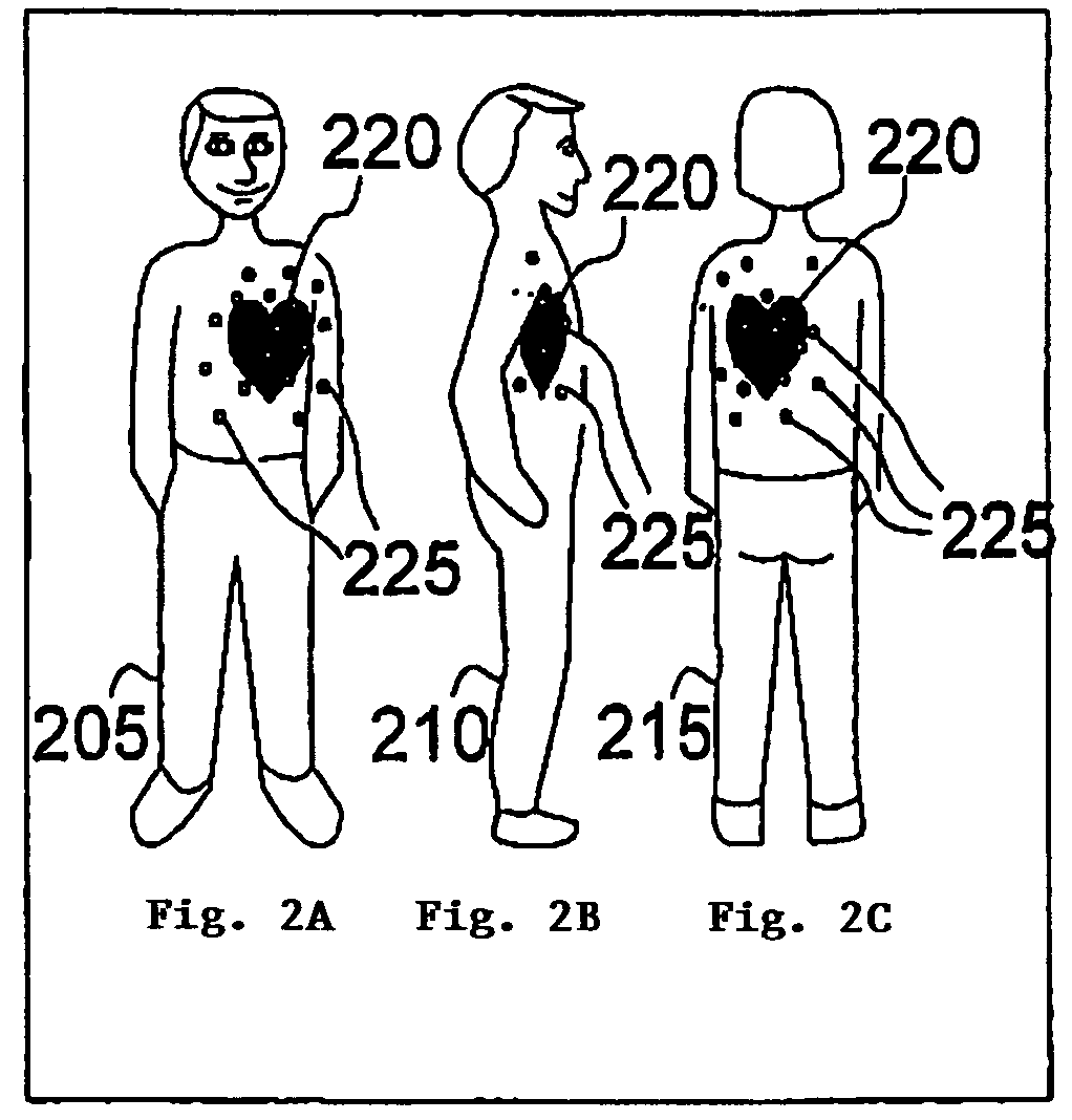 Method of and system for signal separation during multivariate physiological monitoring