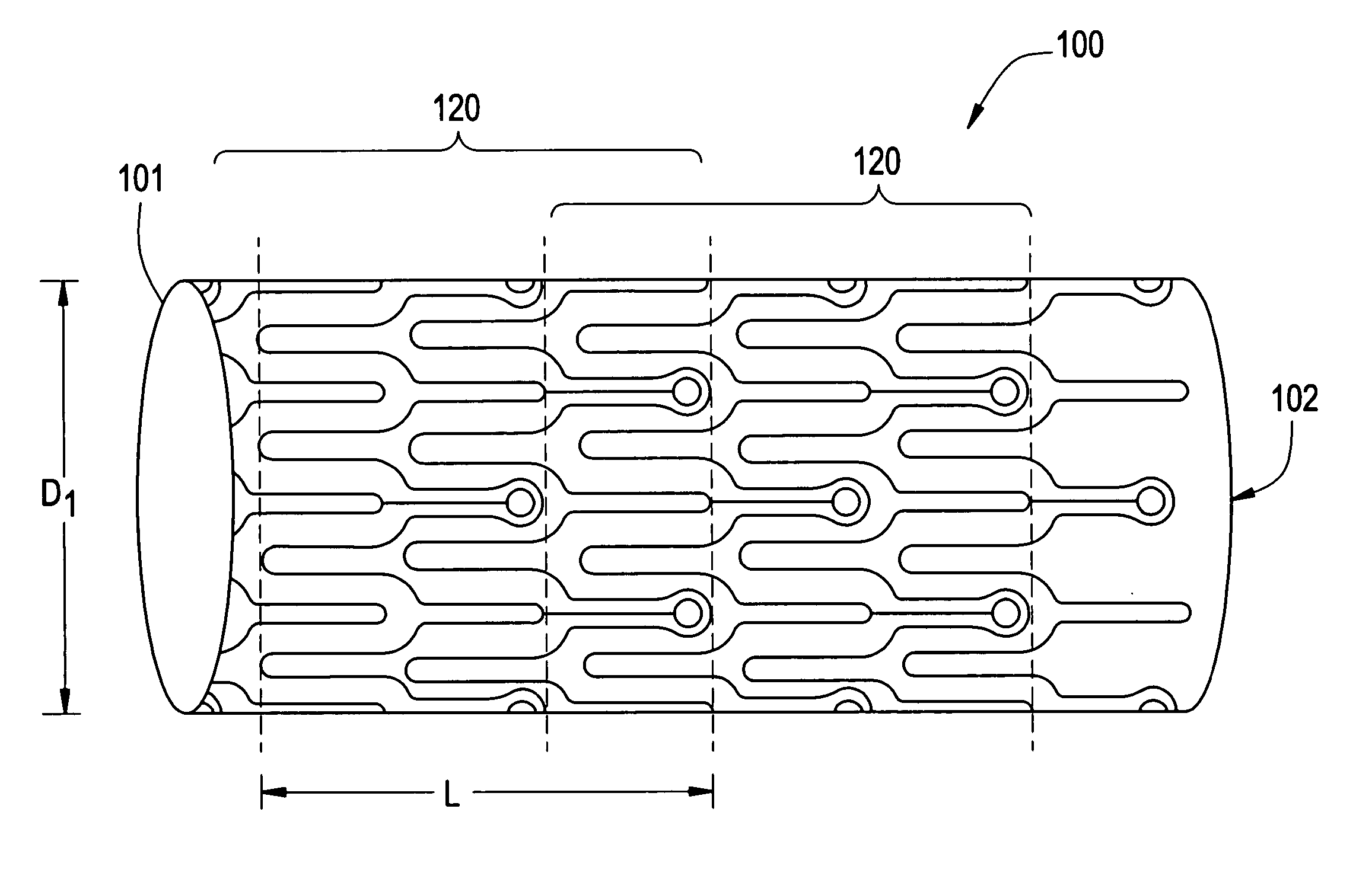 Intraluminal medical device with nested interlocking segments