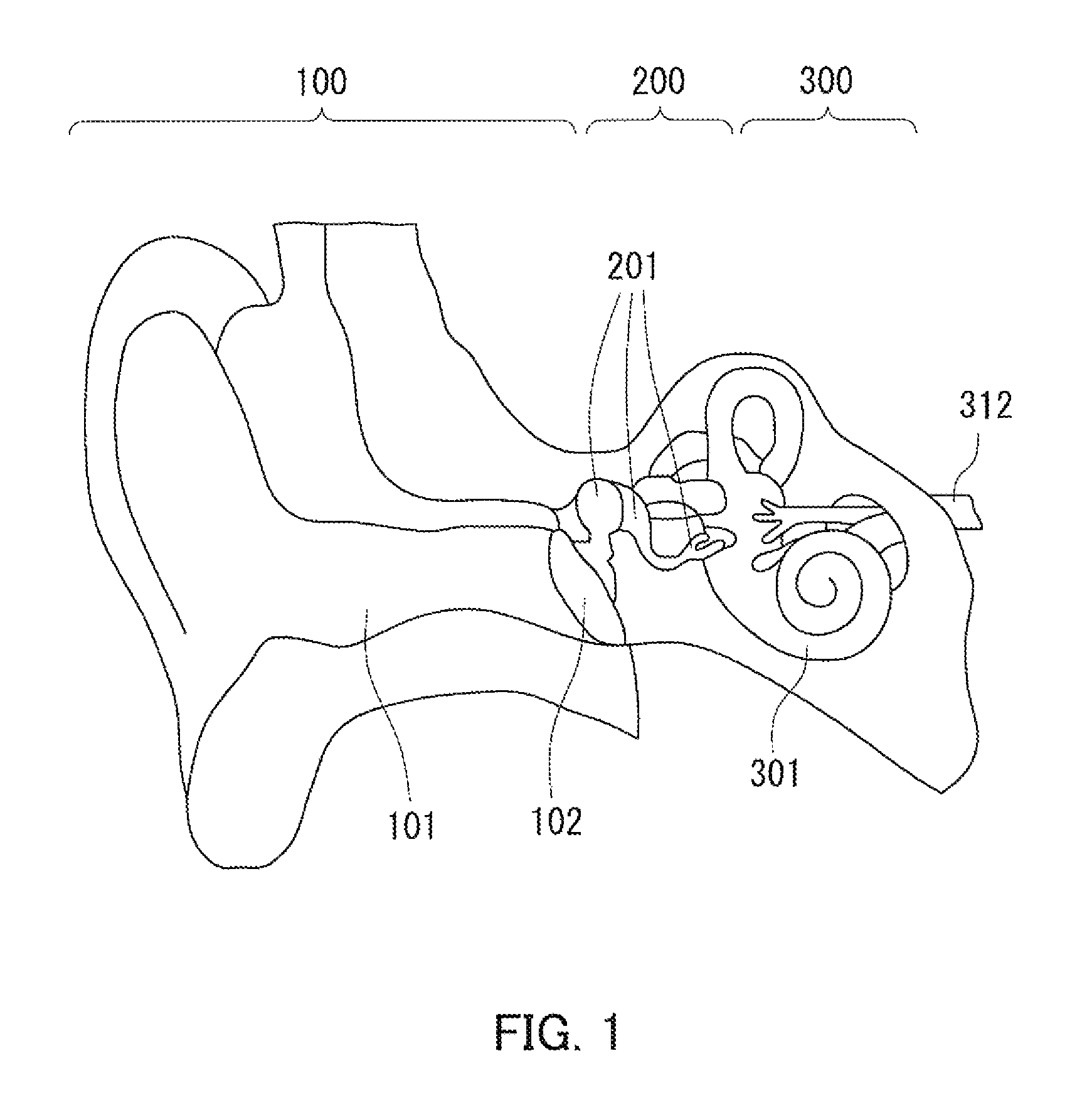 Artificial sensory epithelium