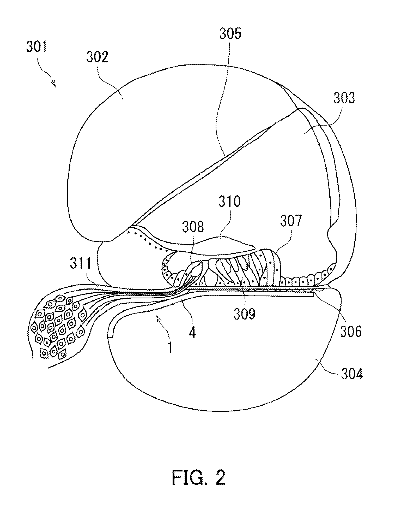 Artificial sensory epithelium