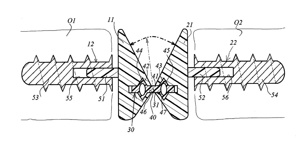 Prosthesis for the restoration of a joint between two bones, and ancillary tool for the assembly thereof