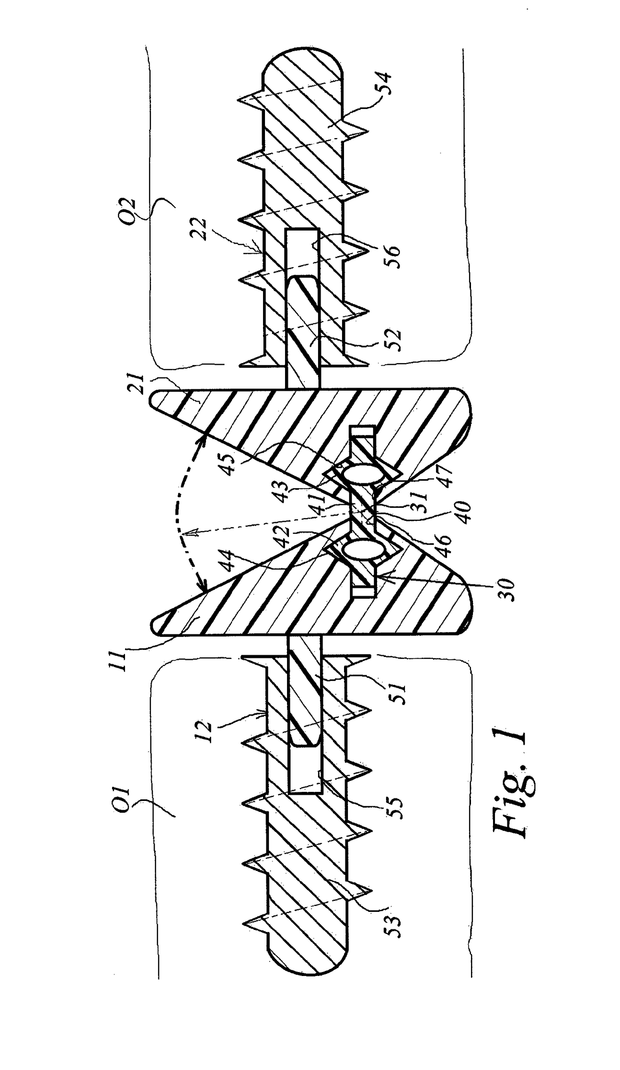 Prosthesis for the restoration of a joint between two bones, and ancillary tool for the assembly thereof