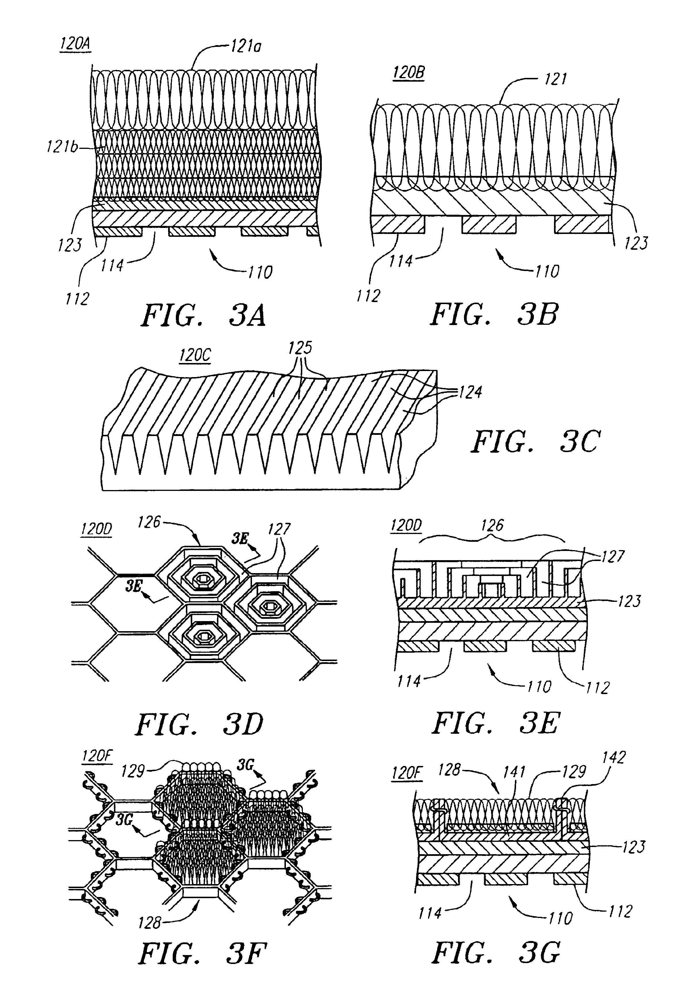 Textured and drug eluting coronary artery stent