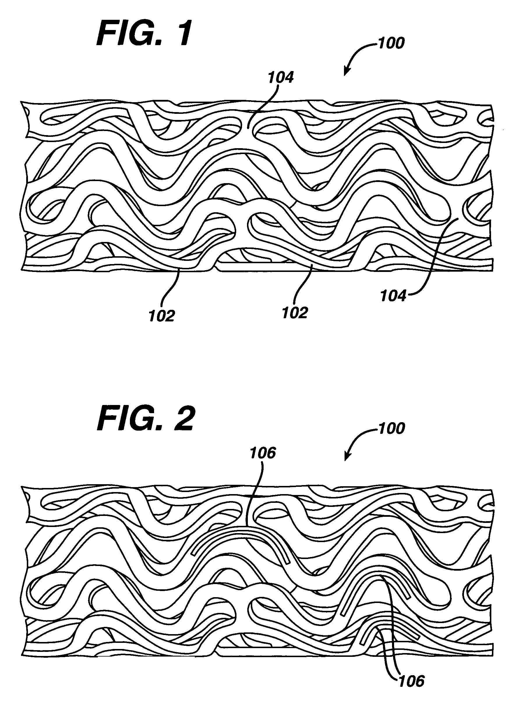 Local administration of a combination of rapamycin and cilostazol for the treatment of vascular disease