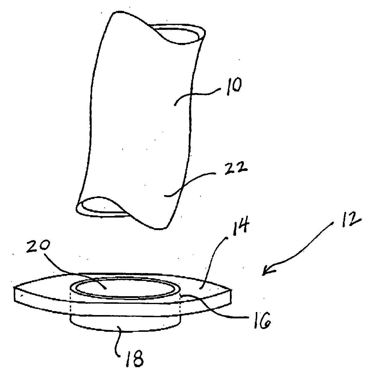 Components, systems, and methods for forming anastomoses using magnetism or other coupling means