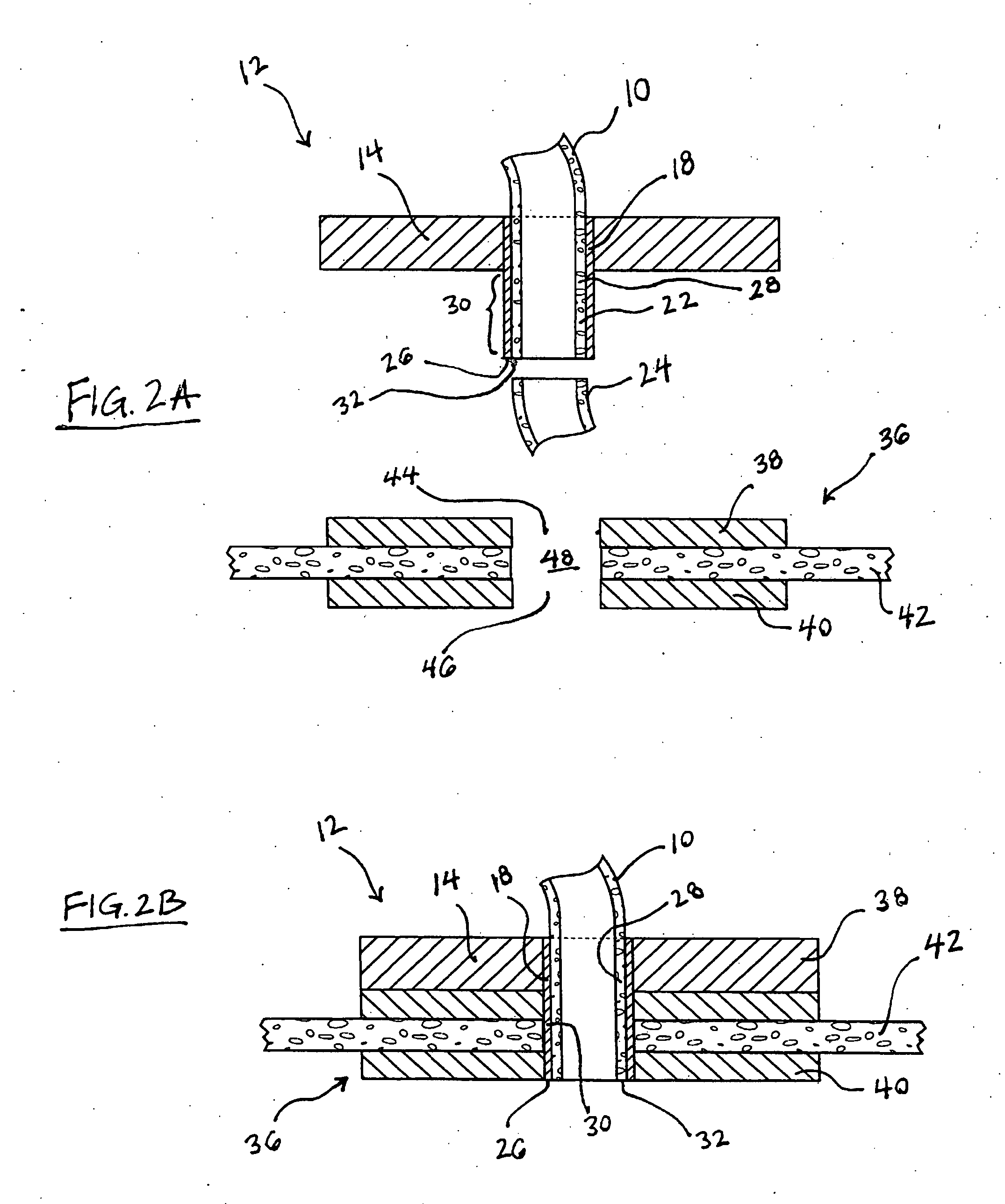 Components, systems, and methods for forming anastomoses using magnetism or other coupling means