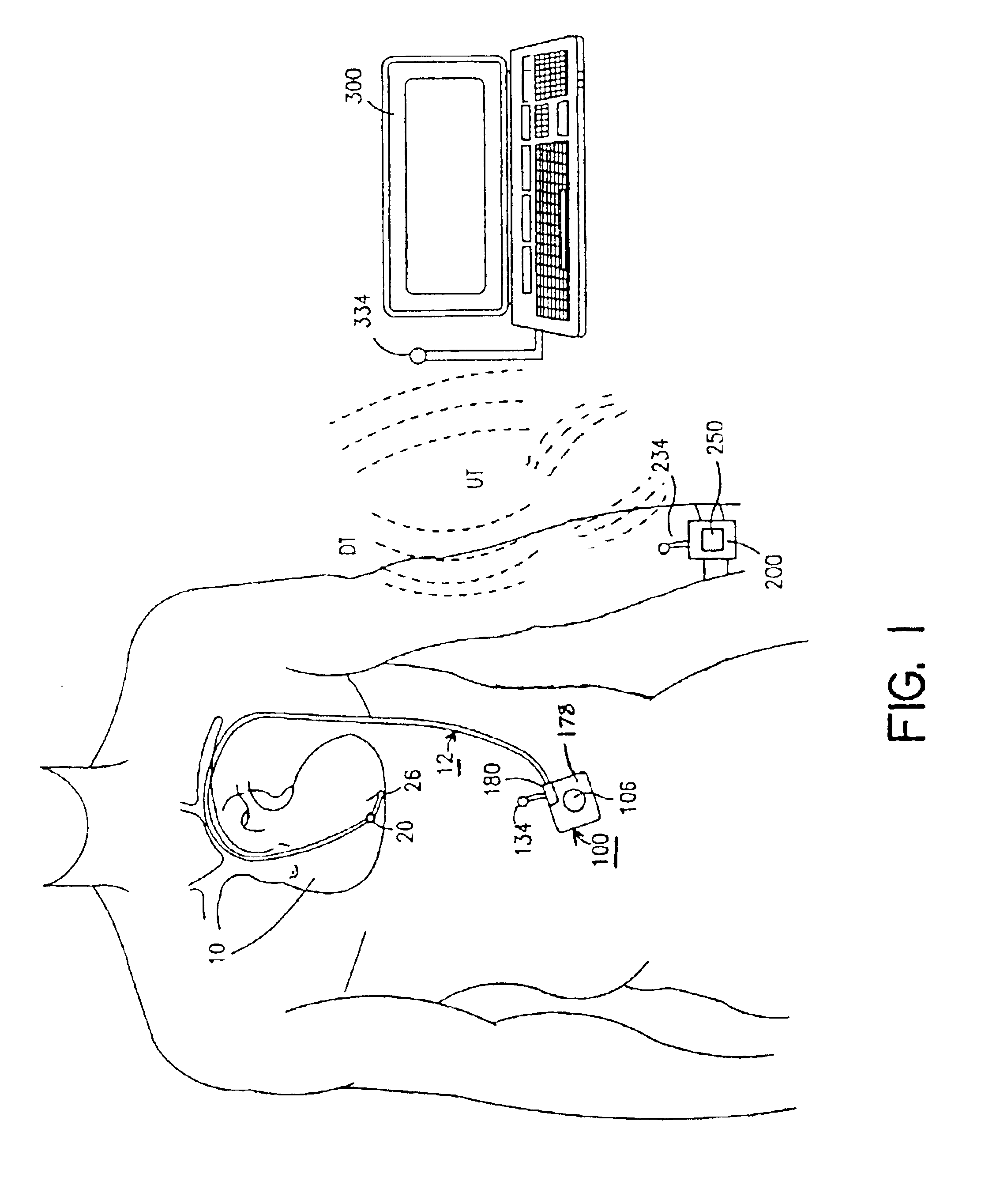 Methods and apparatus for estimation of ventricular afterload based on ventricular pressure measurements