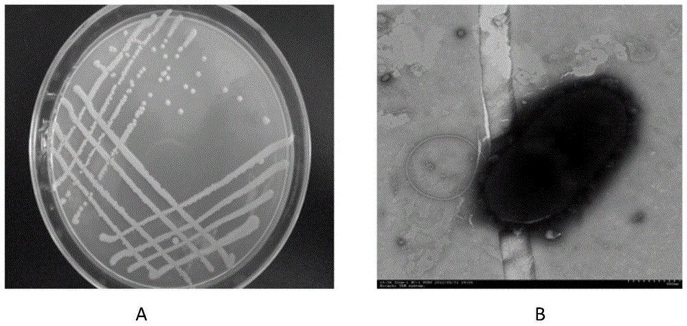 A plant growth-promoting endophytic bacterium with polycyclic aromatic hydrocarbon degradation function and its application