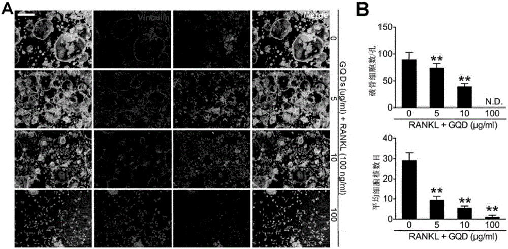 Application of graphene quantum dots to prevention and treatment of osteoporosis