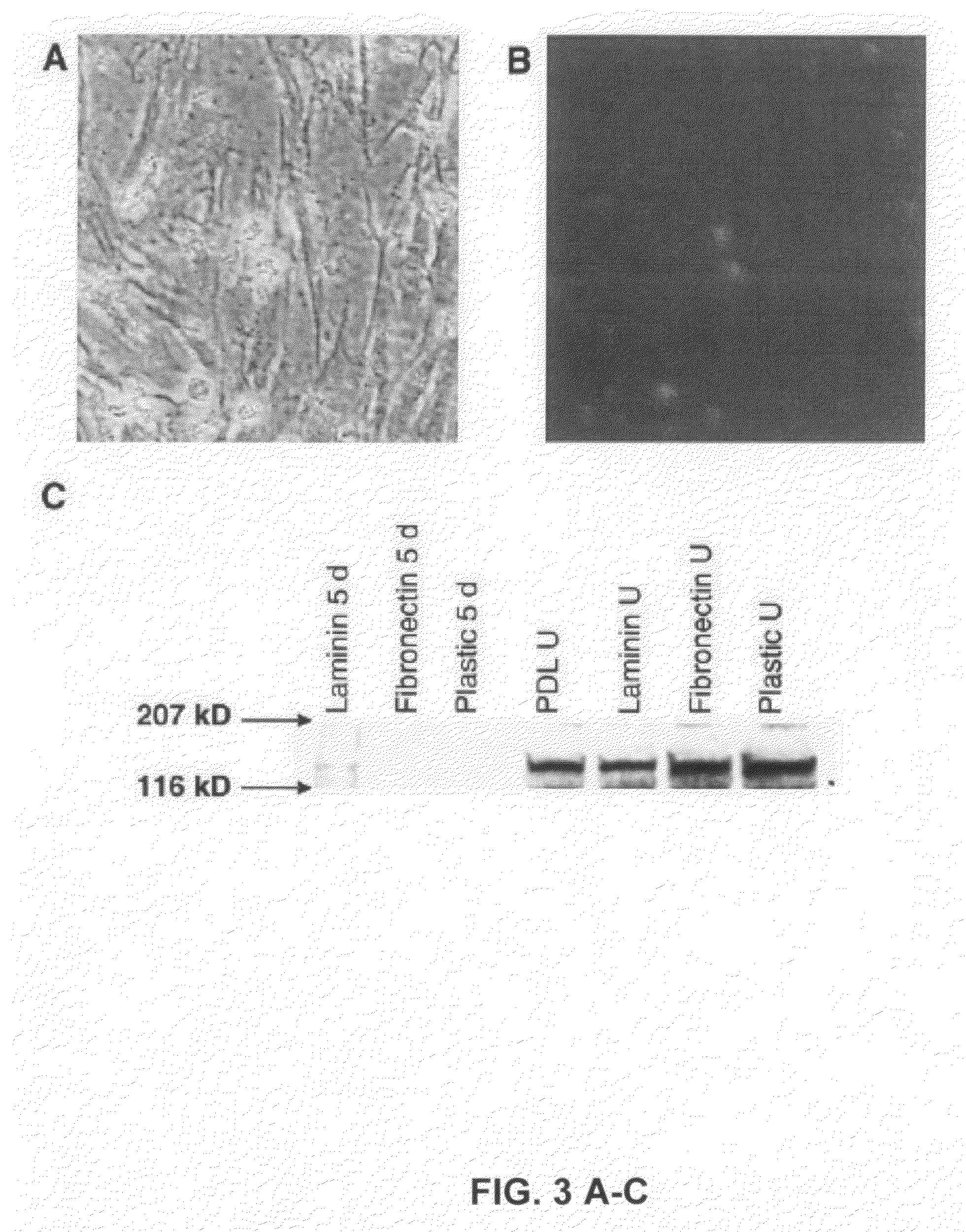 Cultures, products and methods using umbilical cord matrix cells