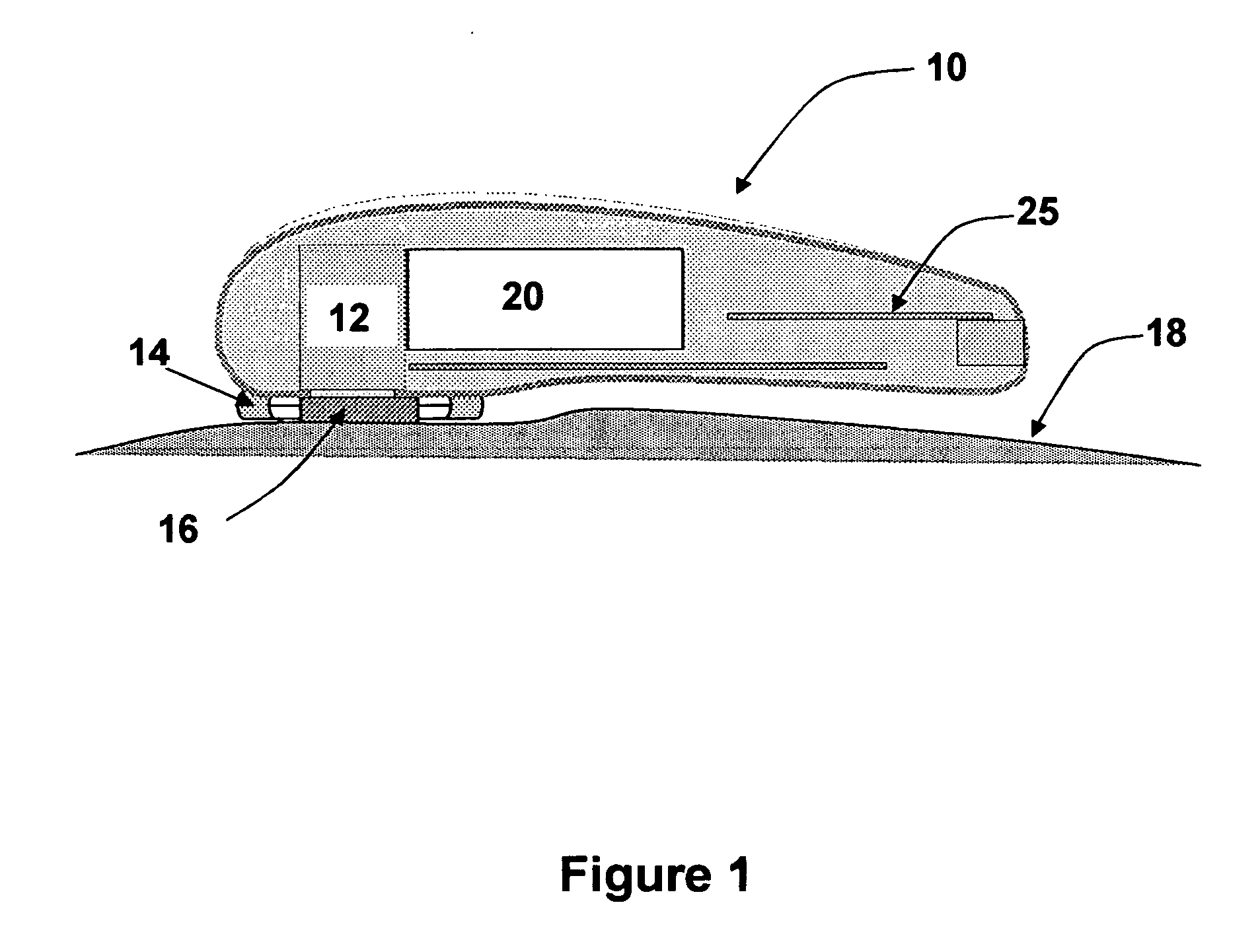 Tissue thickness measurement device