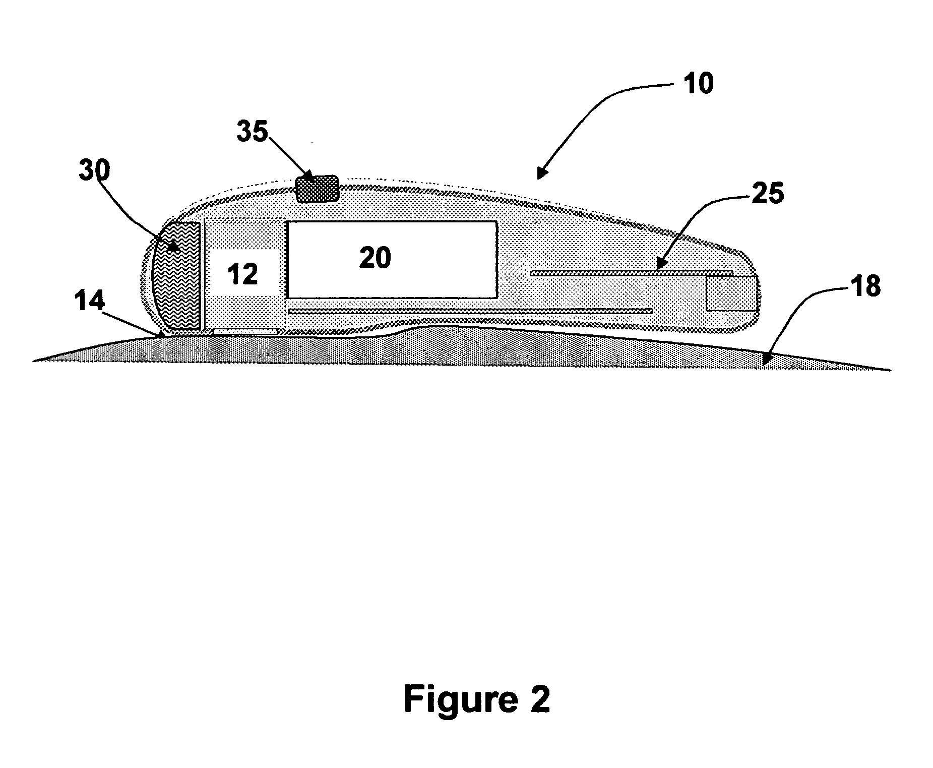 Tissue thickness measurement device