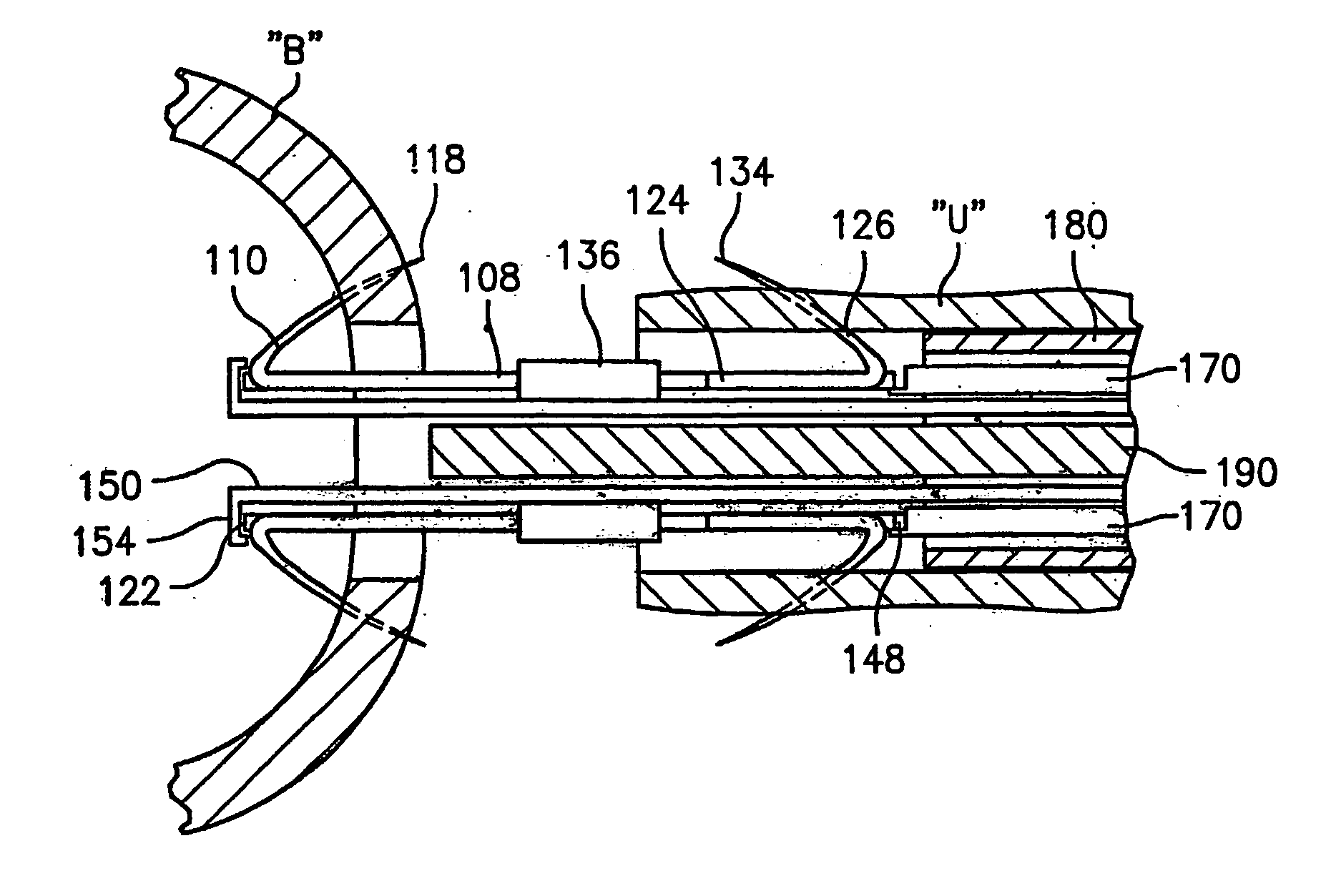 Method and apparatus for anastomosis