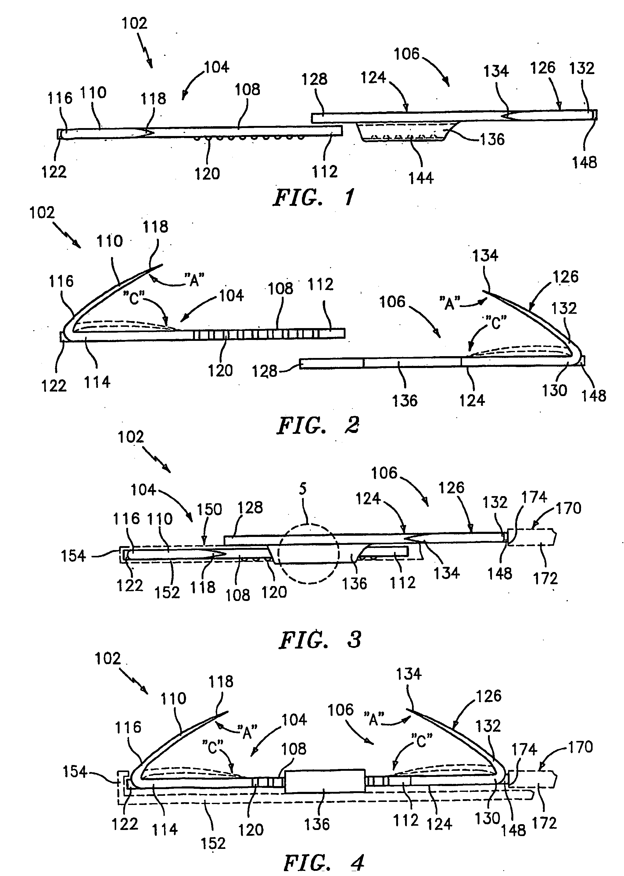 Method and apparatus for anastomosis