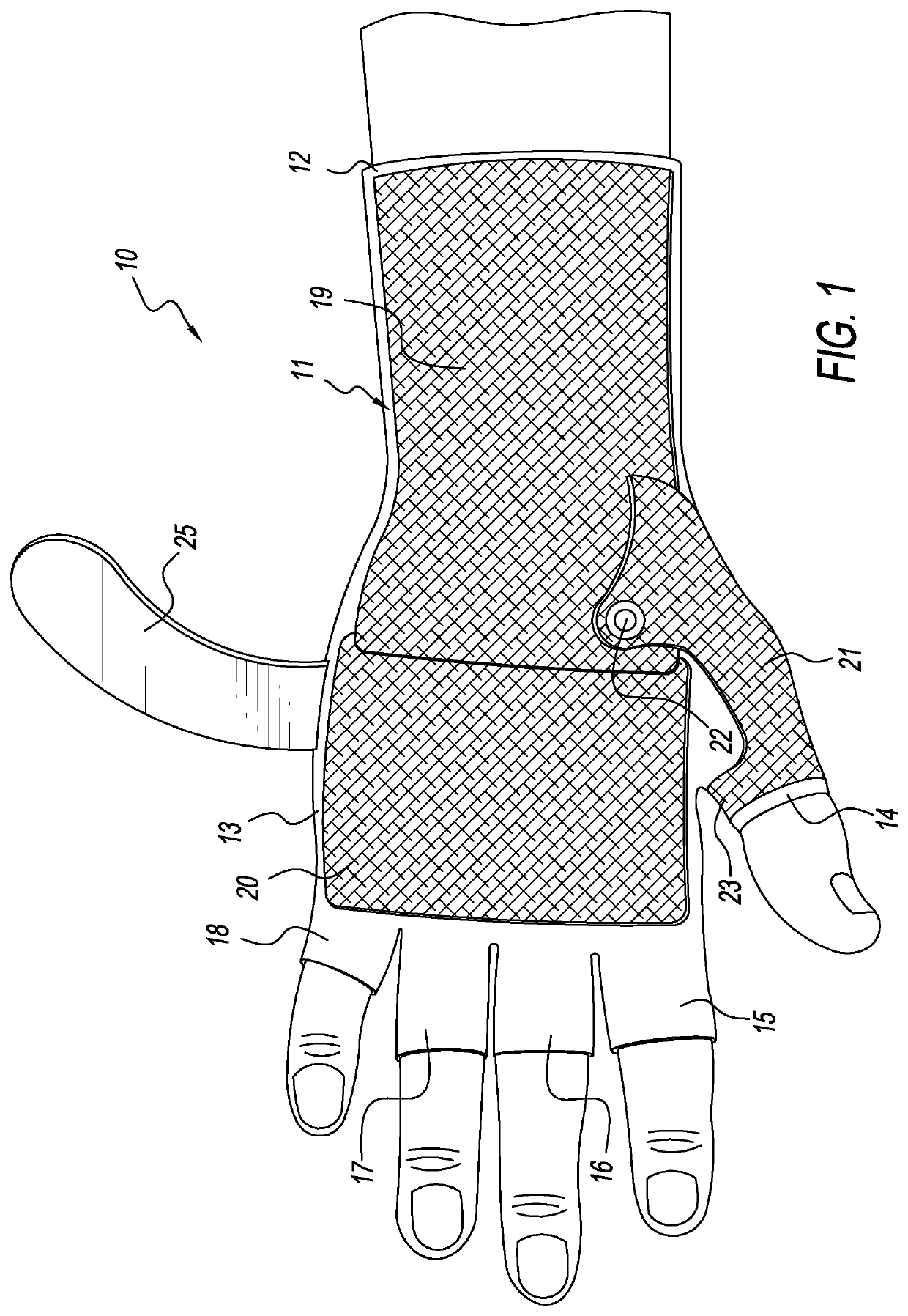 Hand orthoses