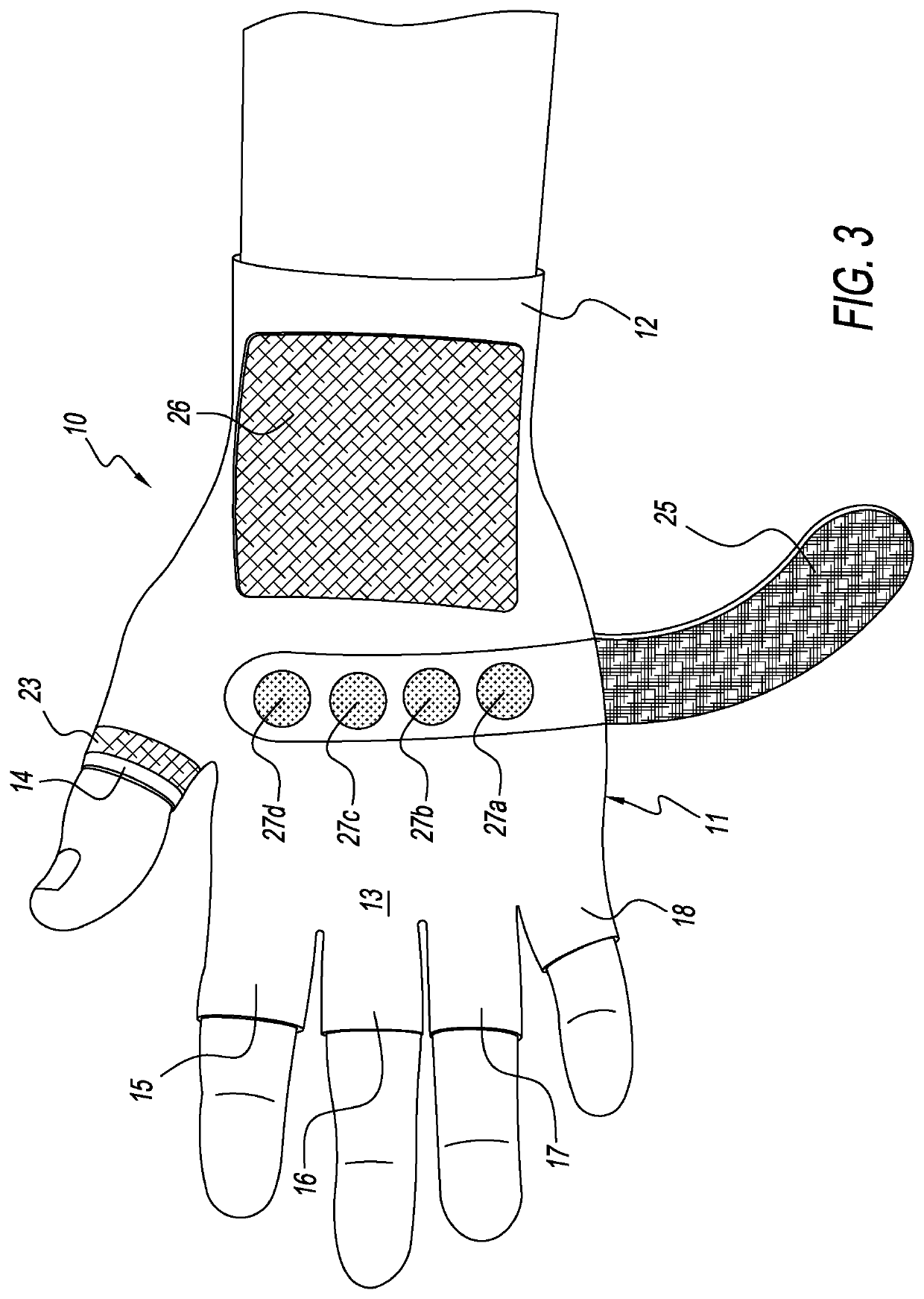 Hand orthoses