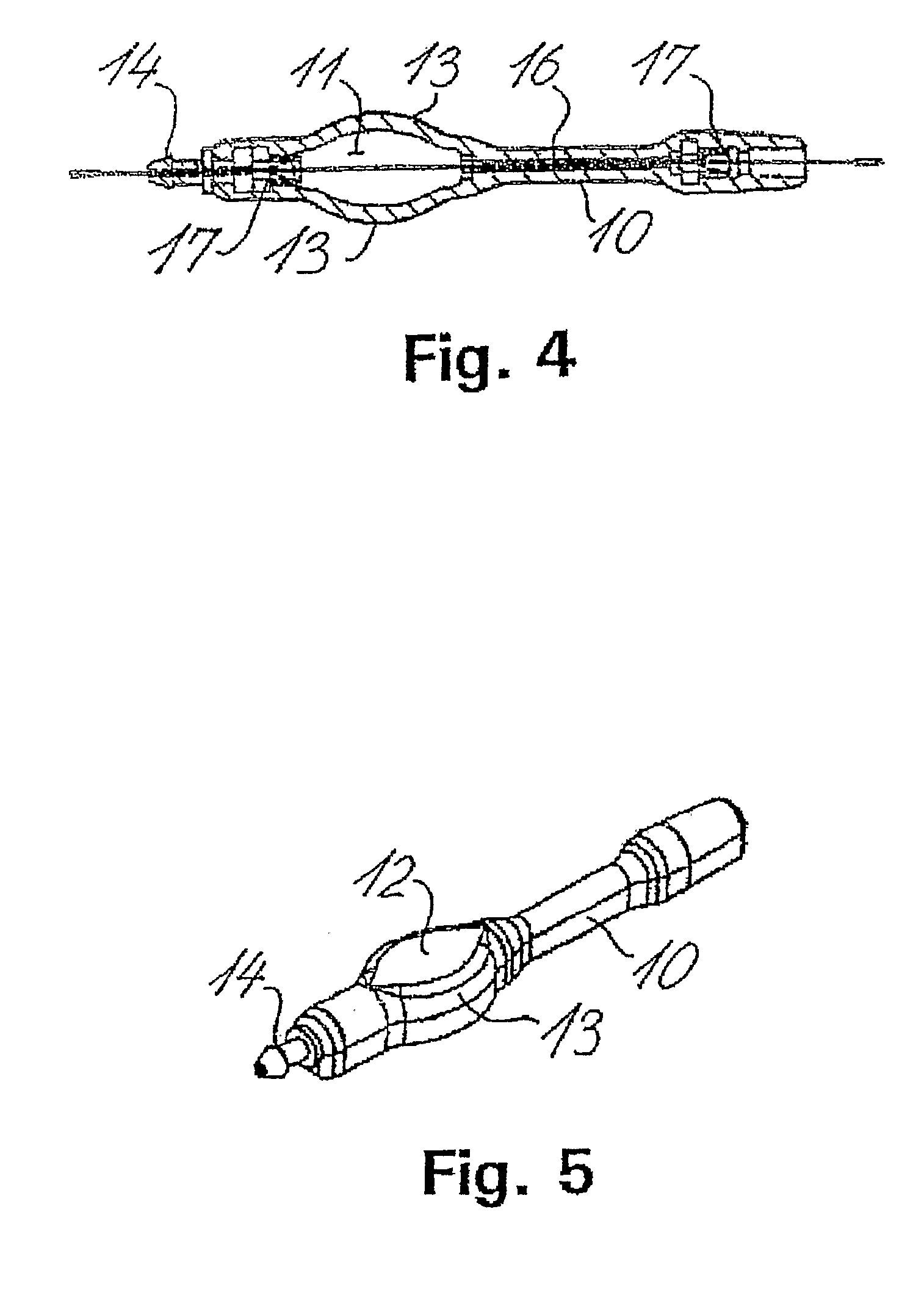 Method for shunting toxic substances from a brain ventricle to the sinus system