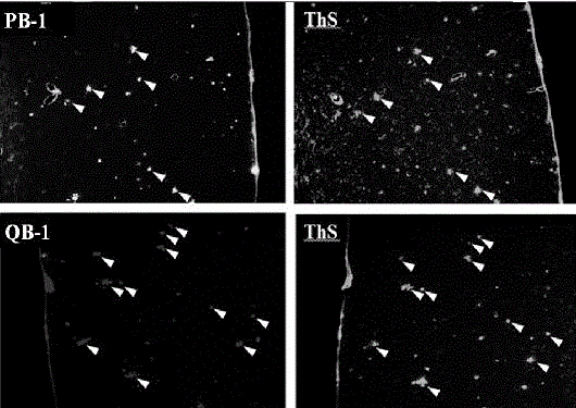 Pyrazine compounds, and medicinal application thereof