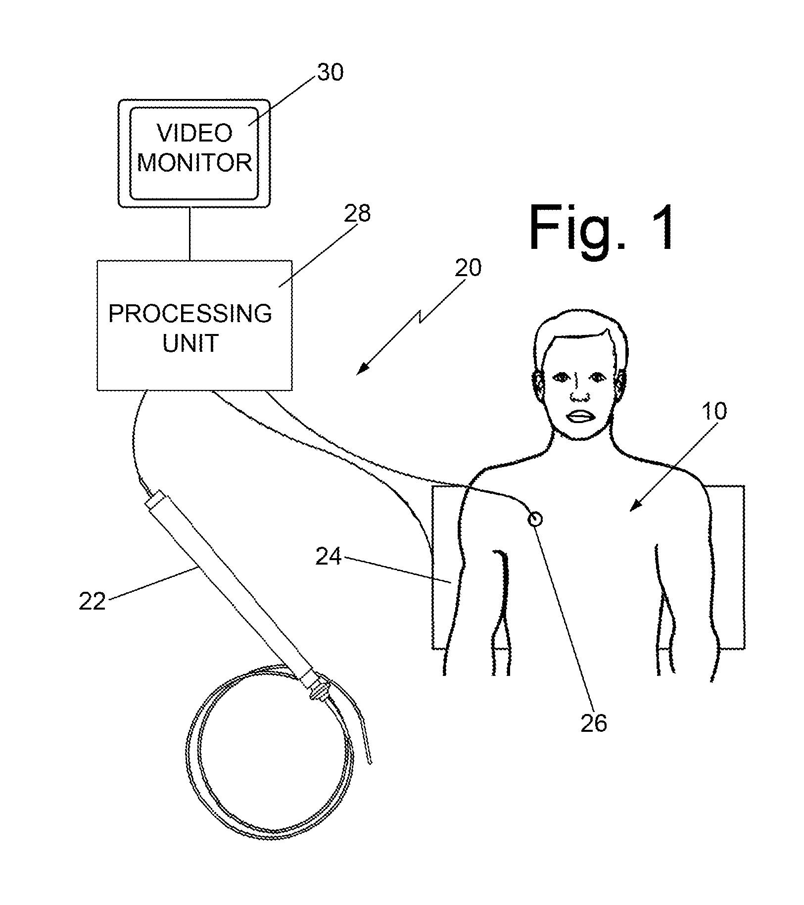 Cardio mapping system and method for cardio mapping