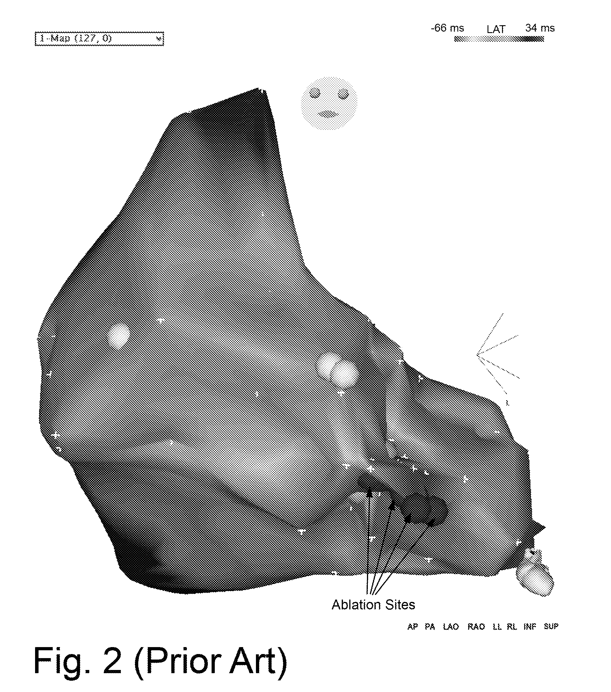 Cardio mapping system and method for cardio mapping