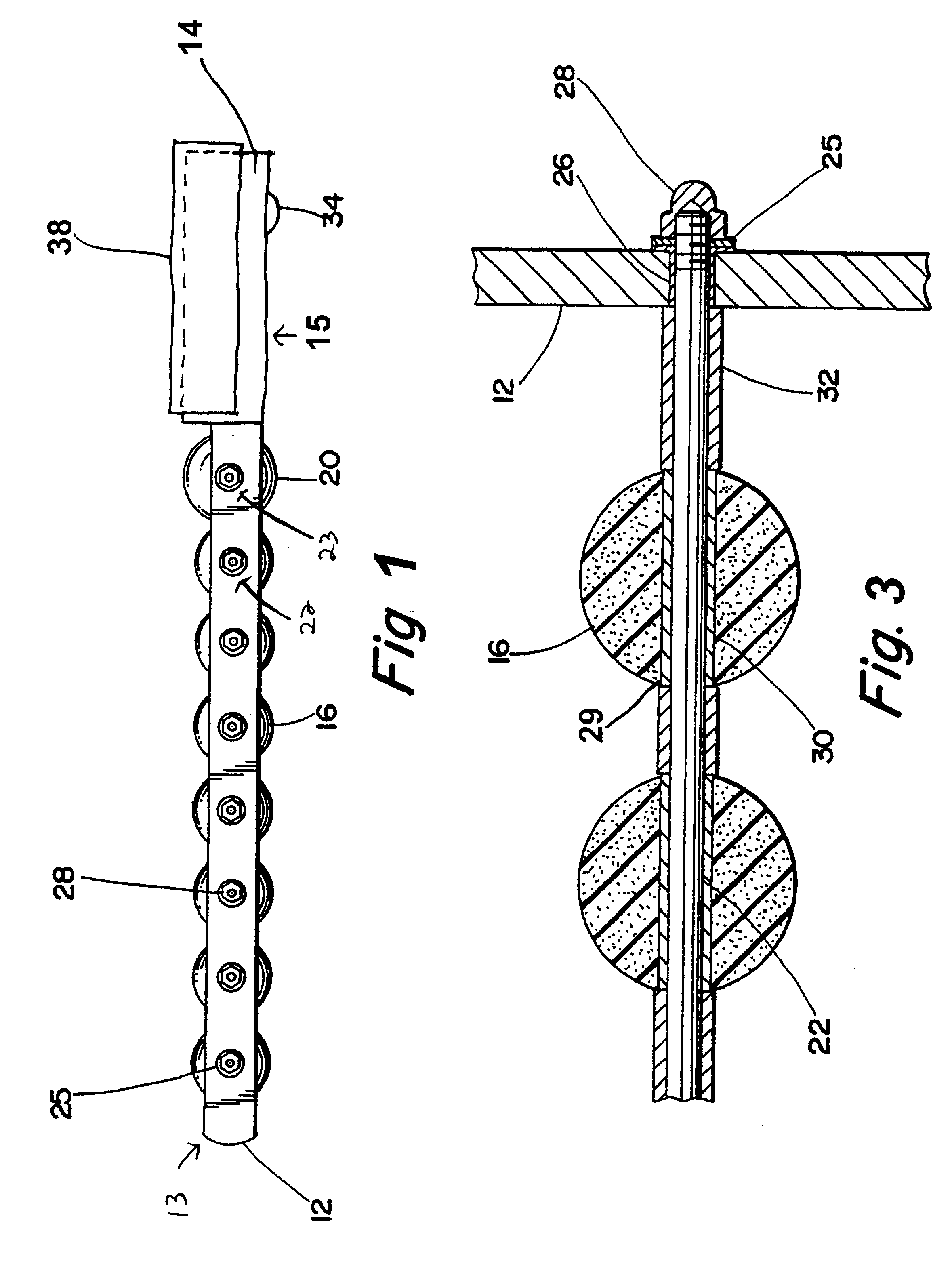 Back stimulator and rehabilitation apparatus