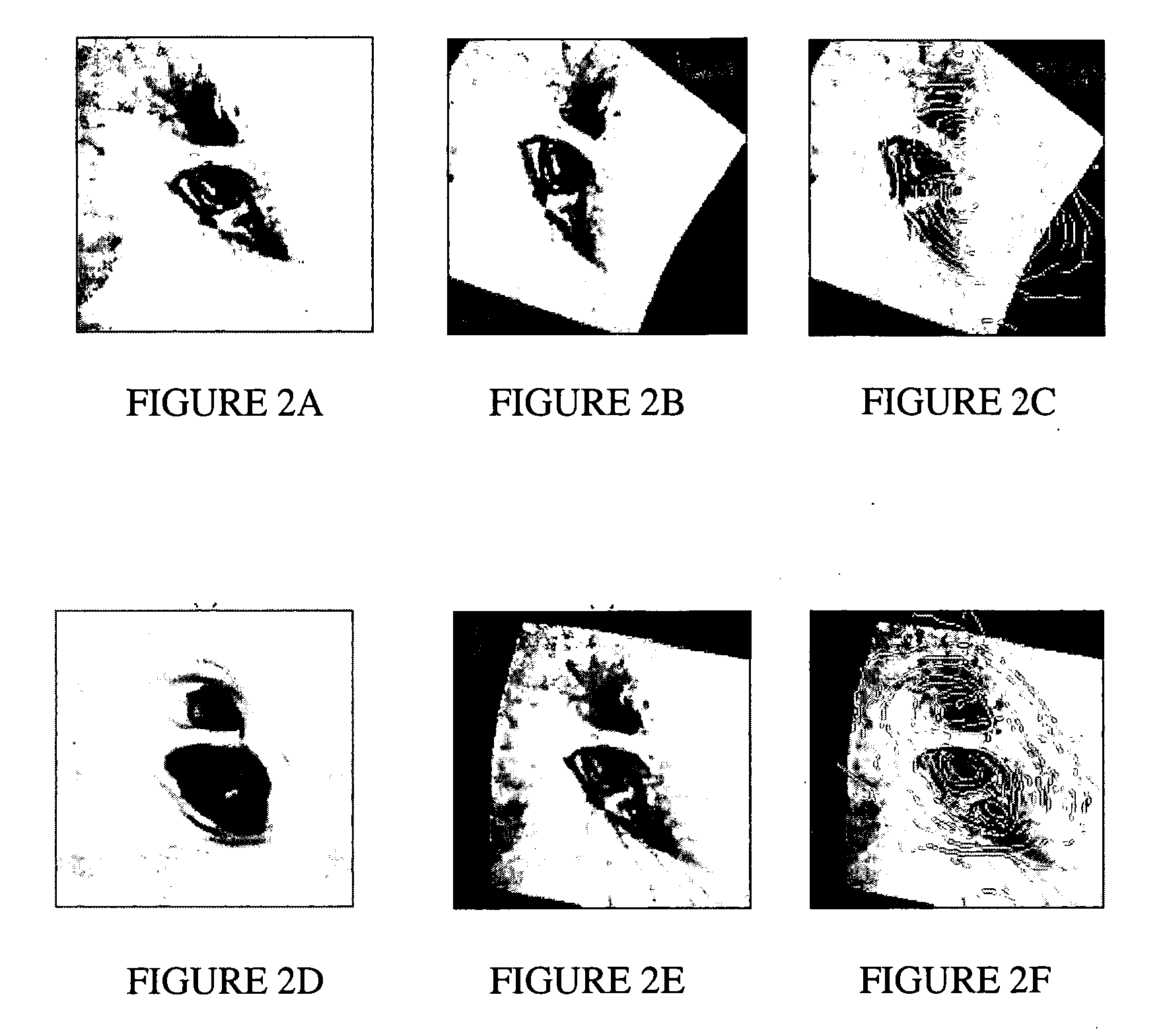 Fast 3D-2D image registration method with application to continuously guided endoscopy