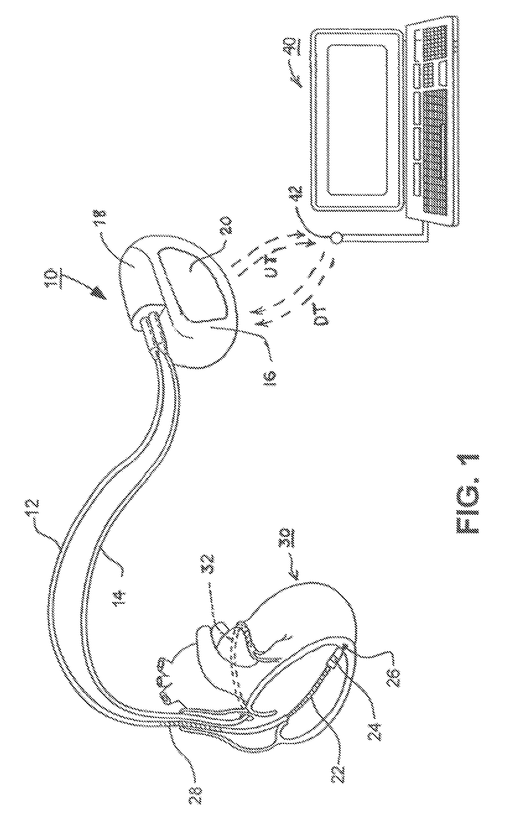 Methods and apparatus for discriminating polymorphic tachyarrhythmias from monomorphic tachyarrhythmias facilitating detection of fibrillation