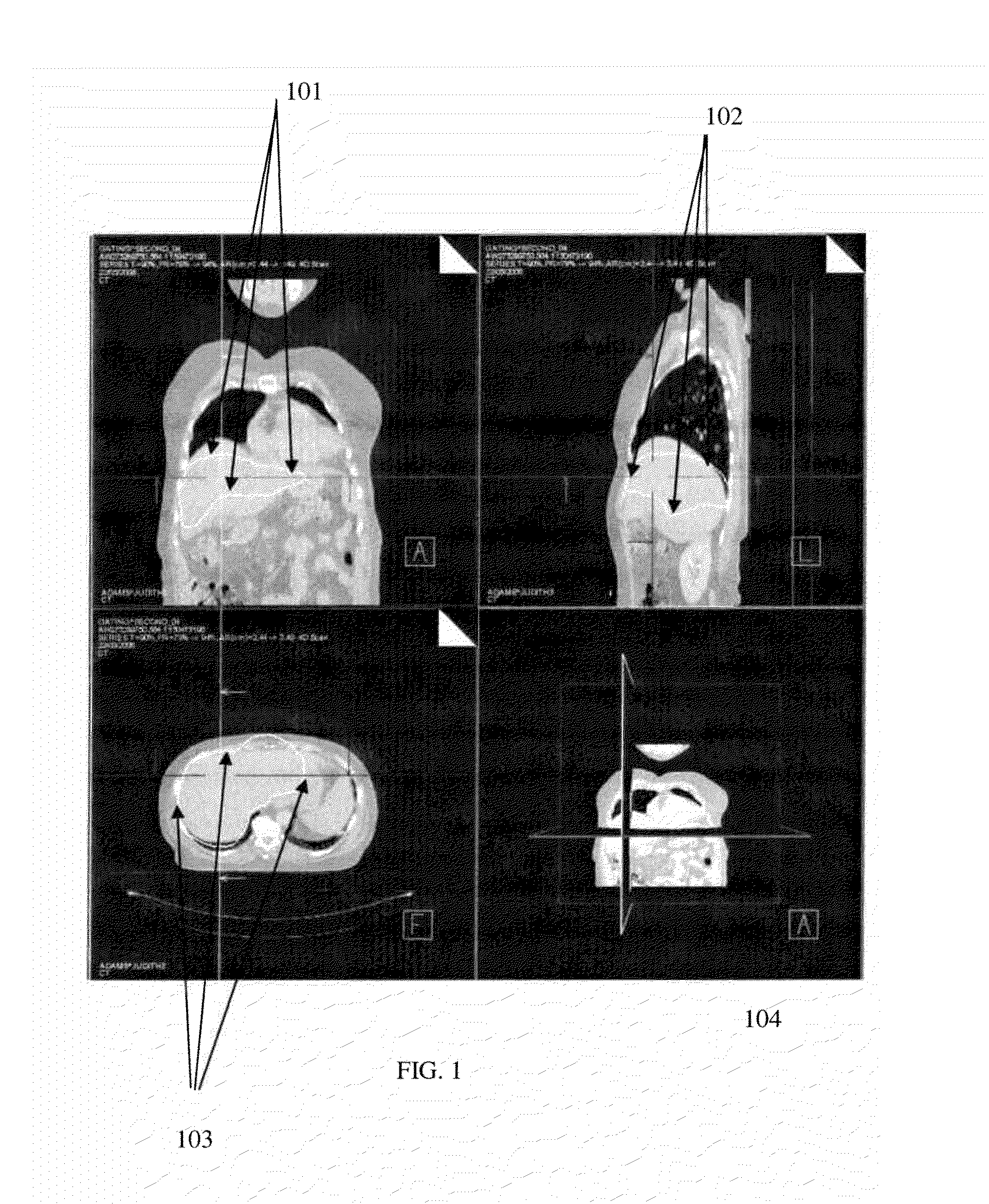 Methods and systems for fully automatic segmentation of medical images