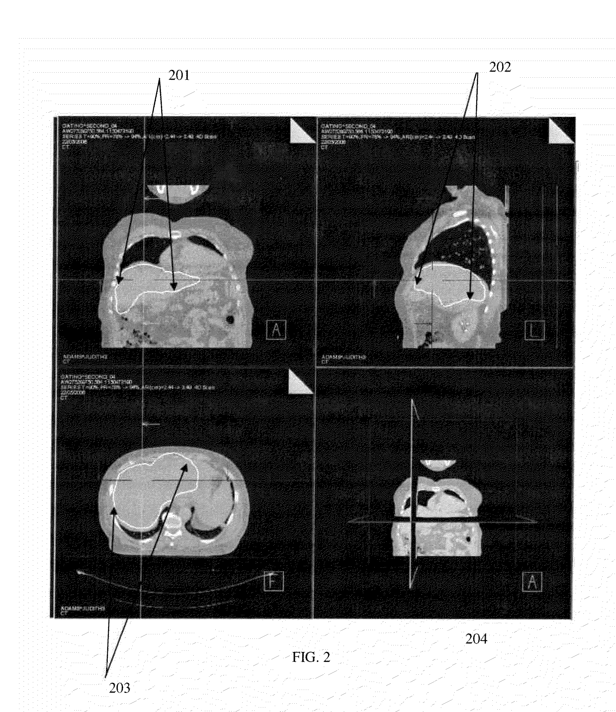 Methods and systems for fully automatic segmentation of medical images