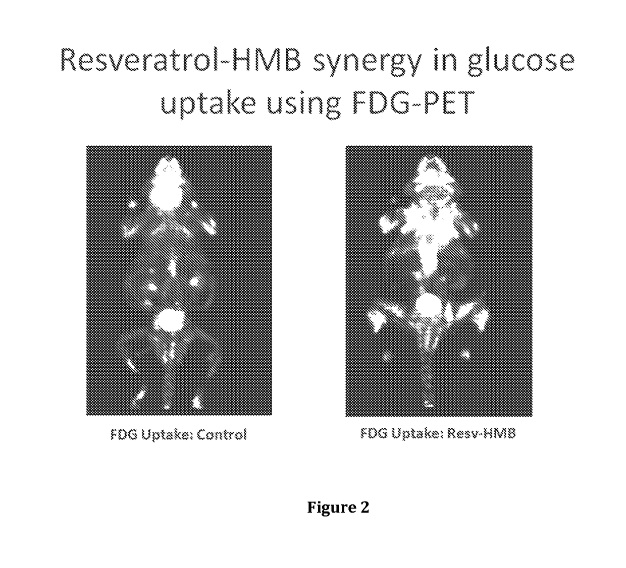 Compositions, methods and kits for treatment of diabetes and/or hyperlipidemia