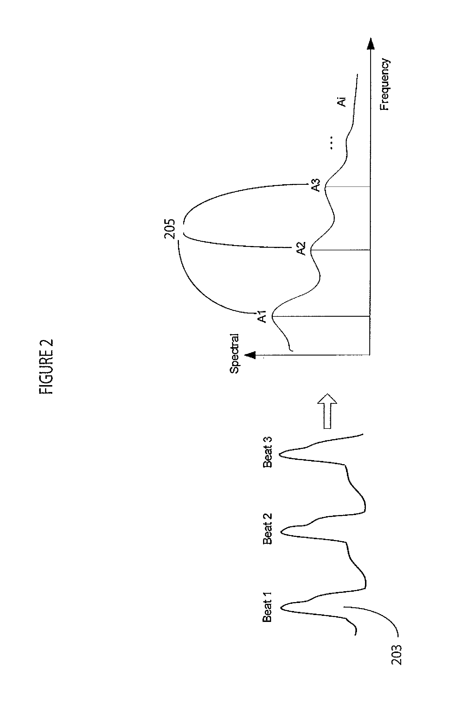 System for cardiac status determination