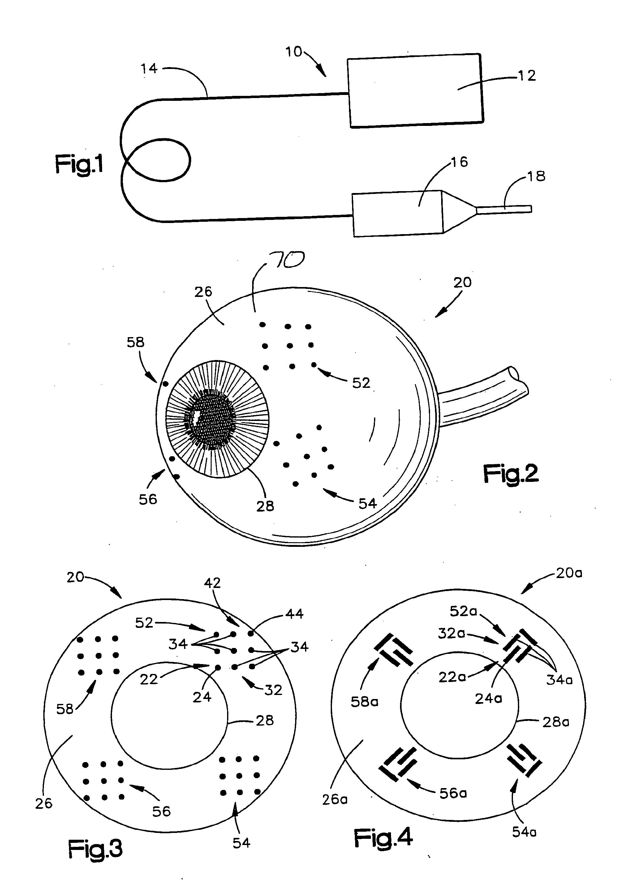 System and method for treating connective tissue