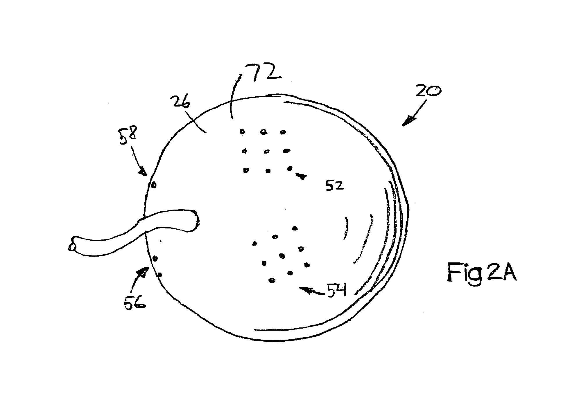 System and method for treating connective tissue