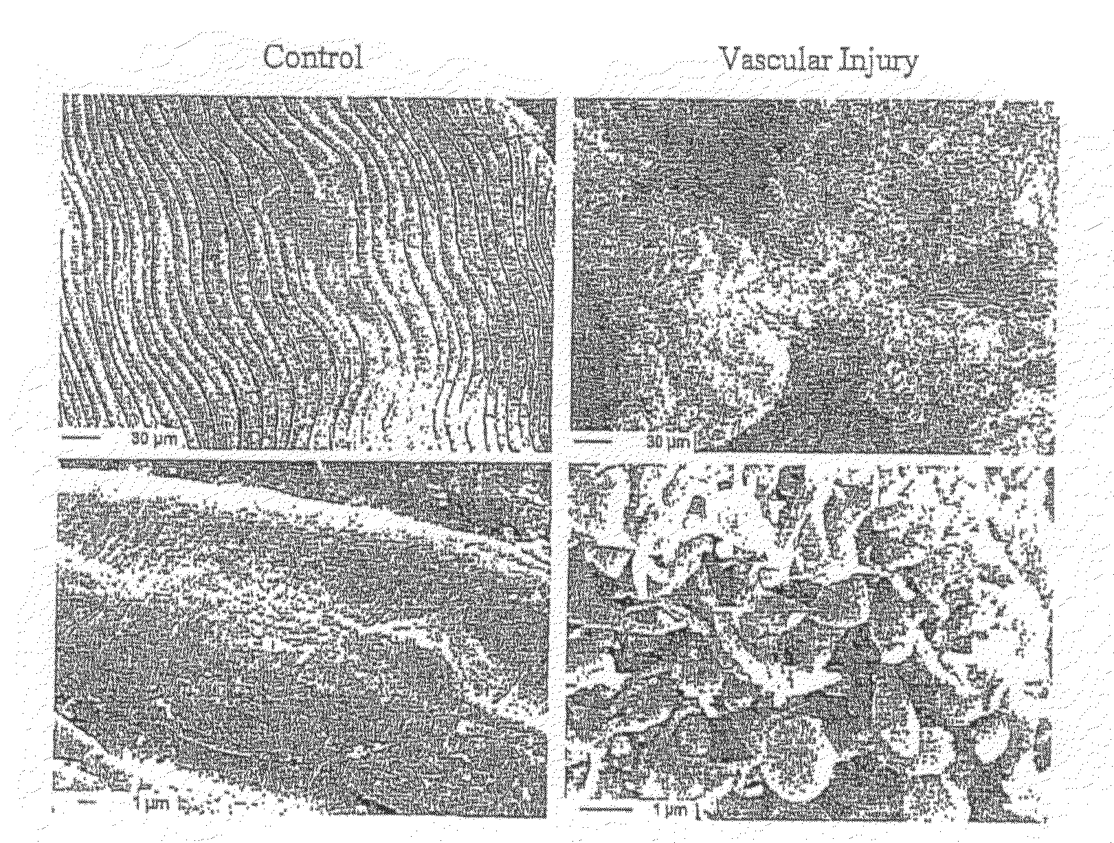 Methods, products and uses involving platelets and/or the vasculature