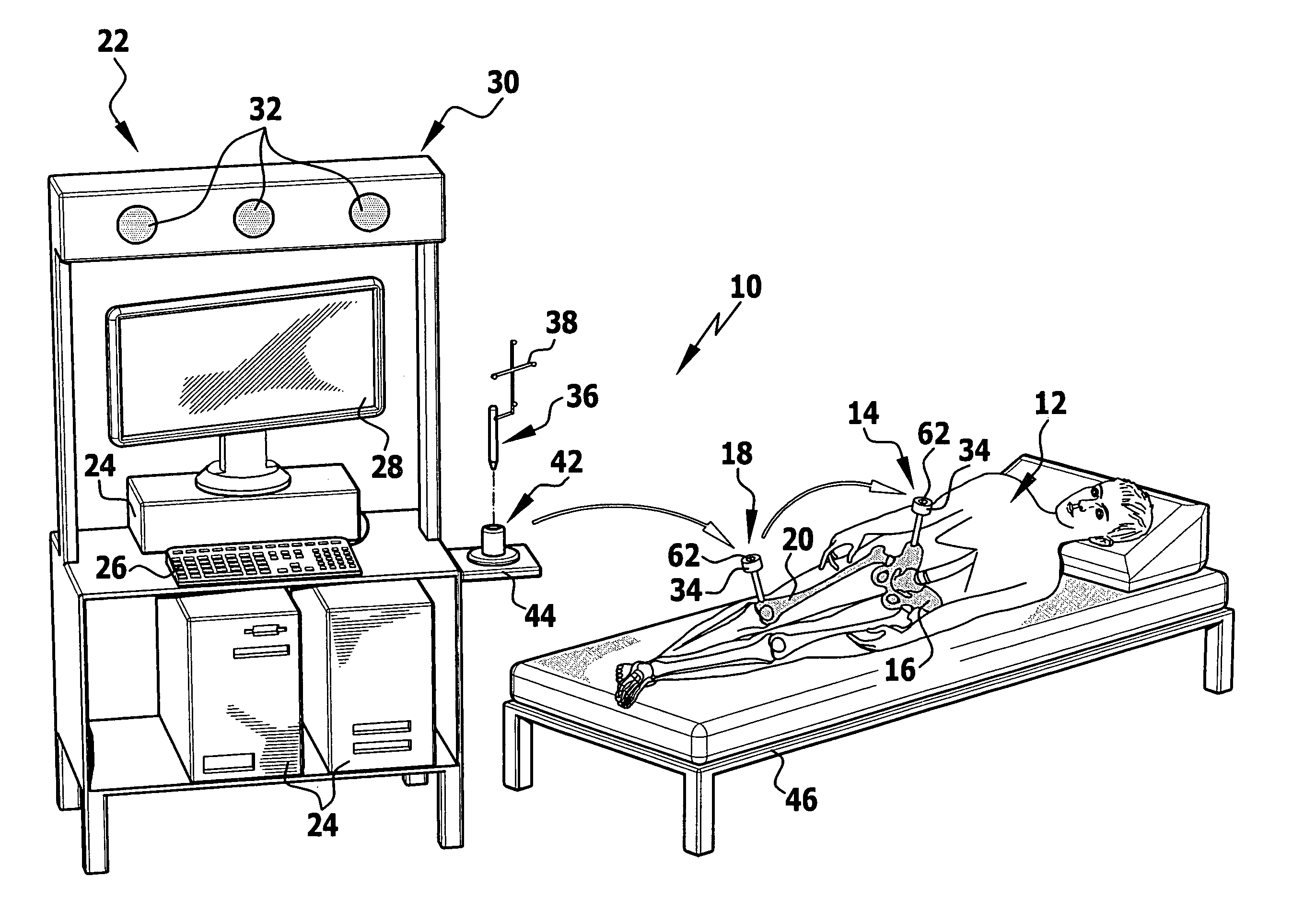 Calibration method and calibration device for a surgical referencing unit