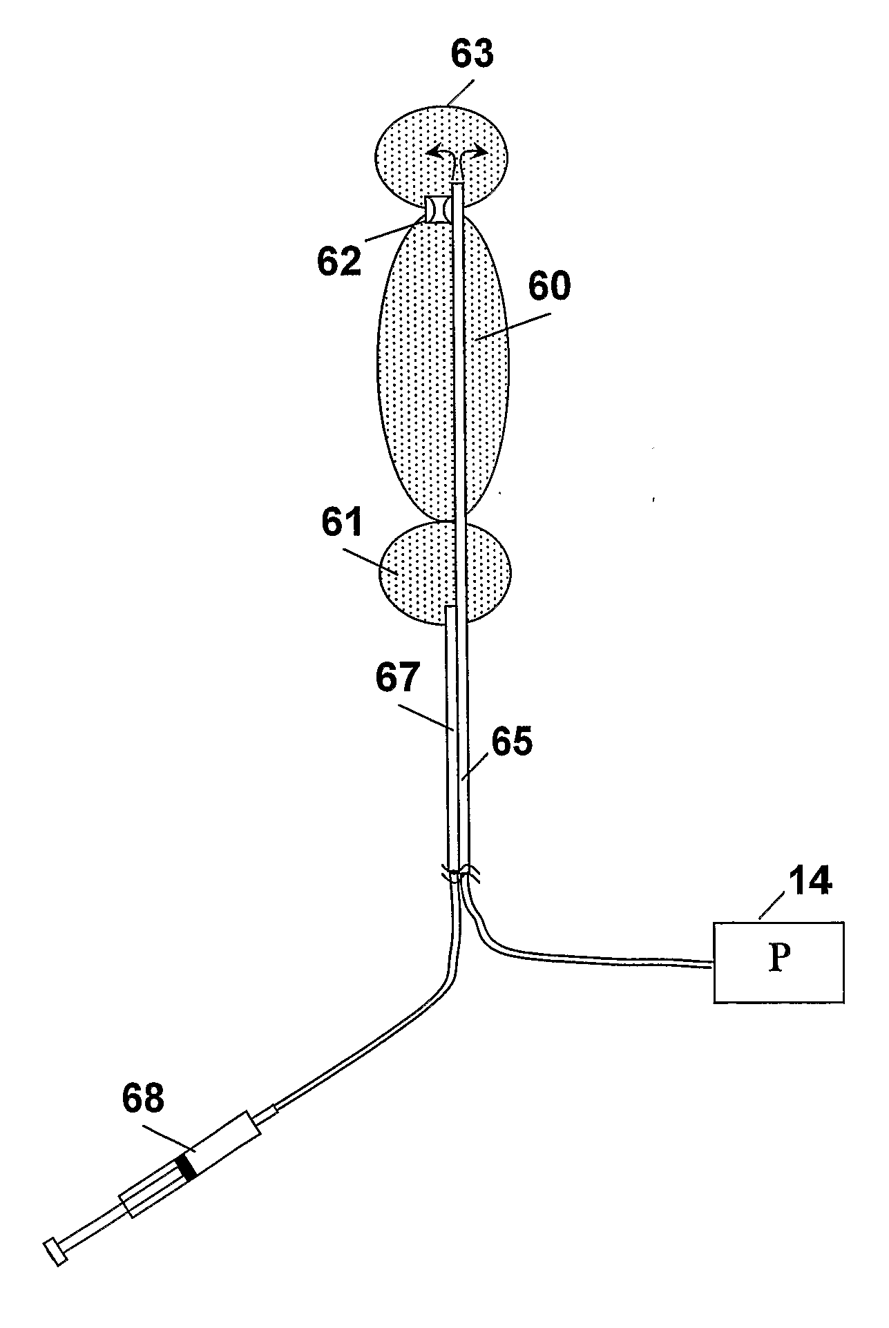 Apparatus and method for direct organ perfusion