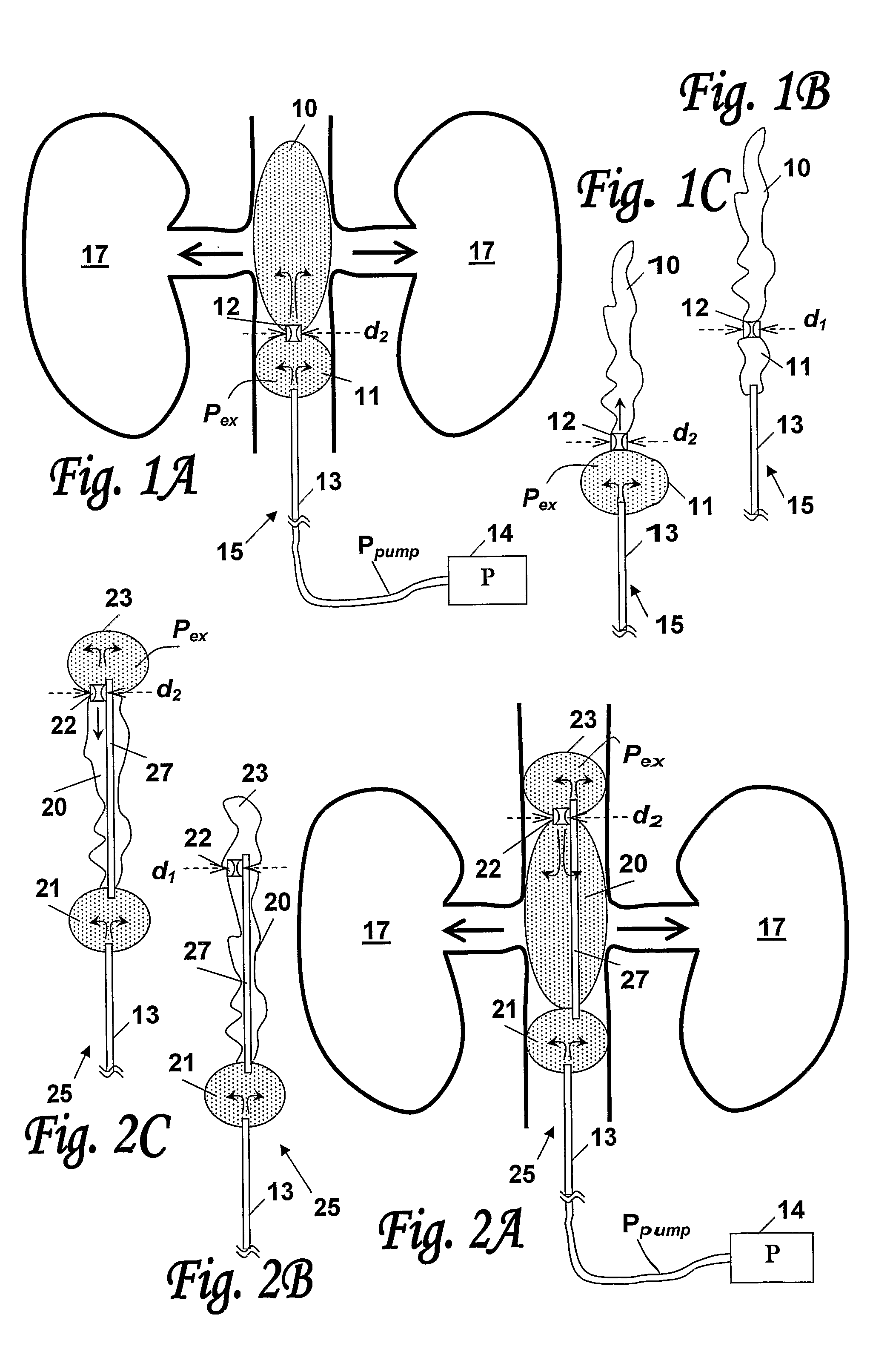 Apparatus and method for direct organ perfusion