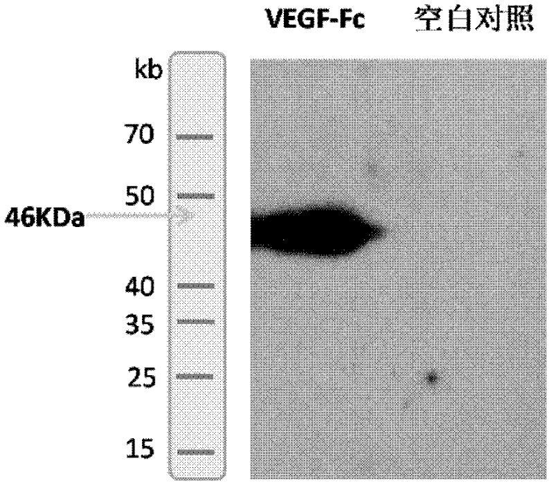 A fusion protein of endothelial cell growth factor and its application in regenerative medicine